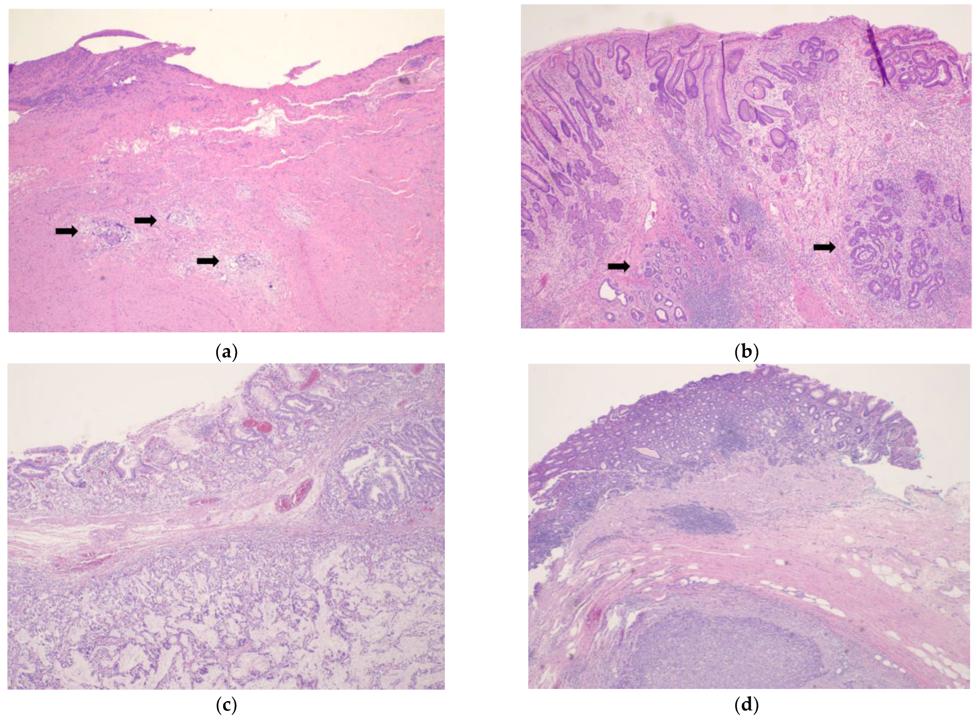 Cancers 15 03662 g001