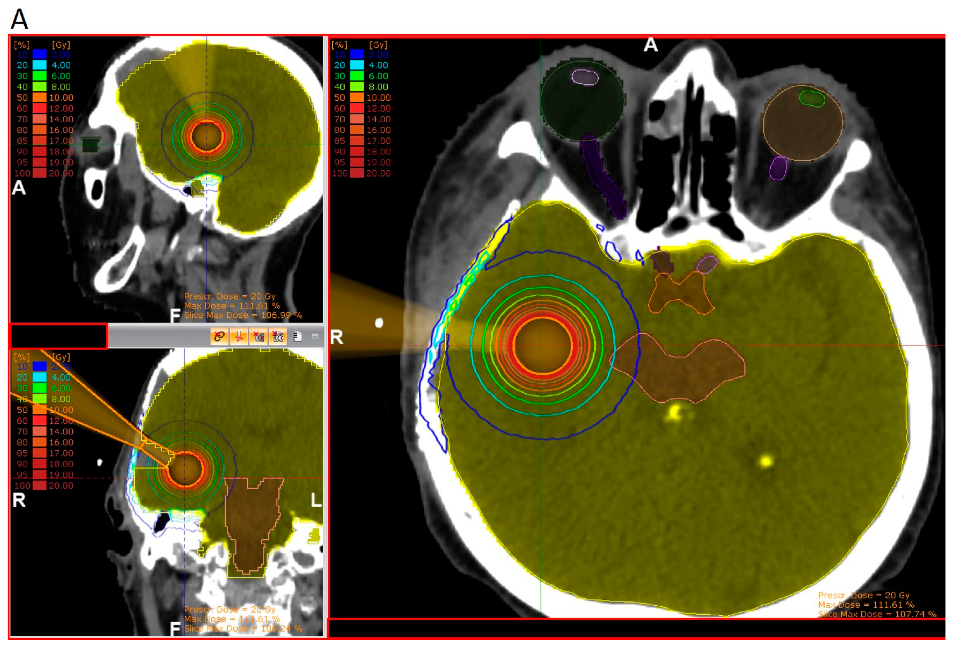 Cancers 15 03670 g002a