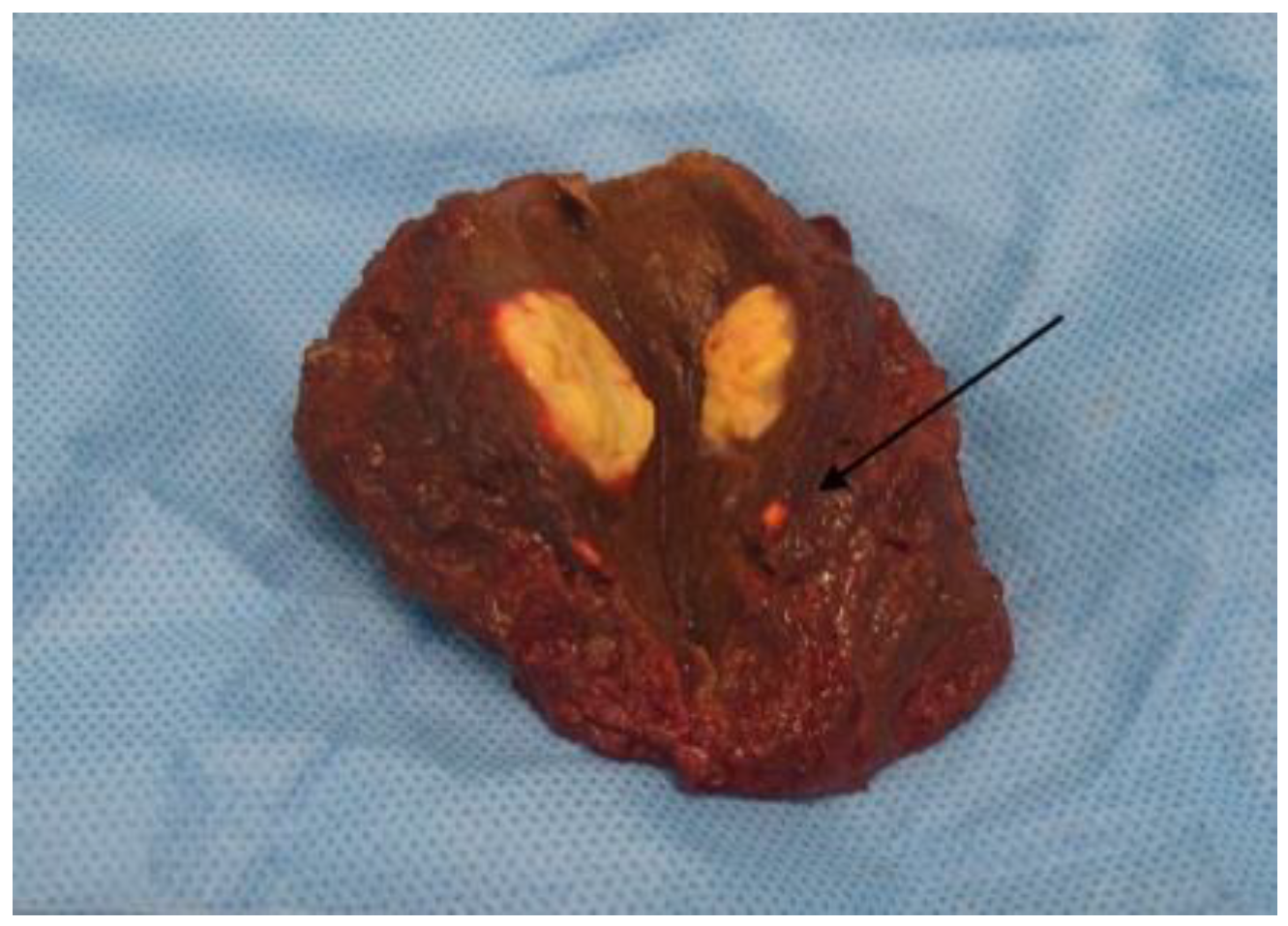 Cancers 15 03694 g001 Cancers 15 03694 g001