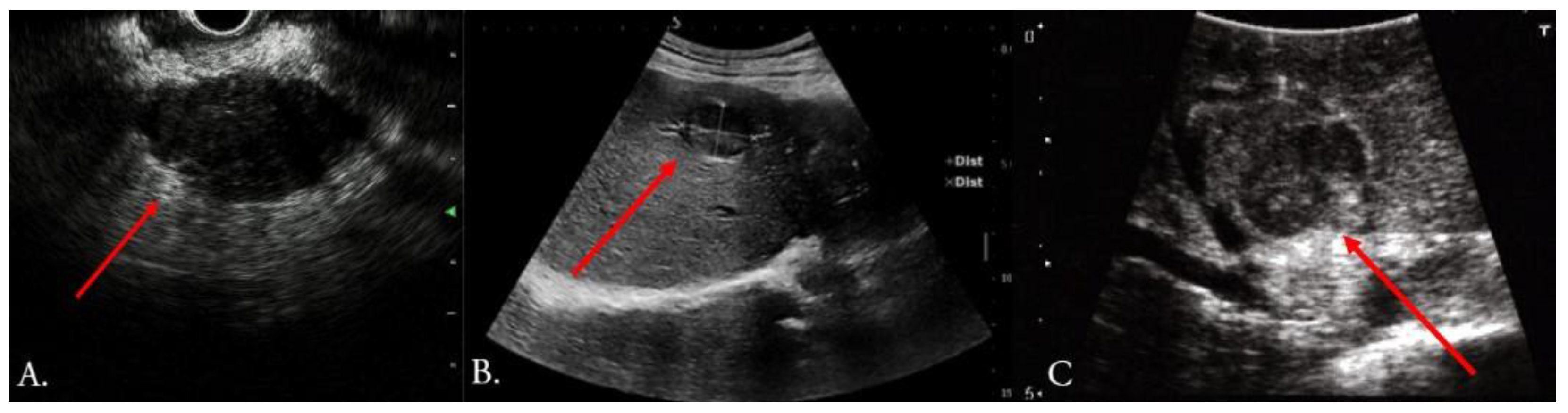 Cancers 15 03694 g002 Cancers 15 03694 g002