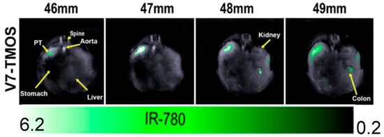 Cancers 15 03694 g005