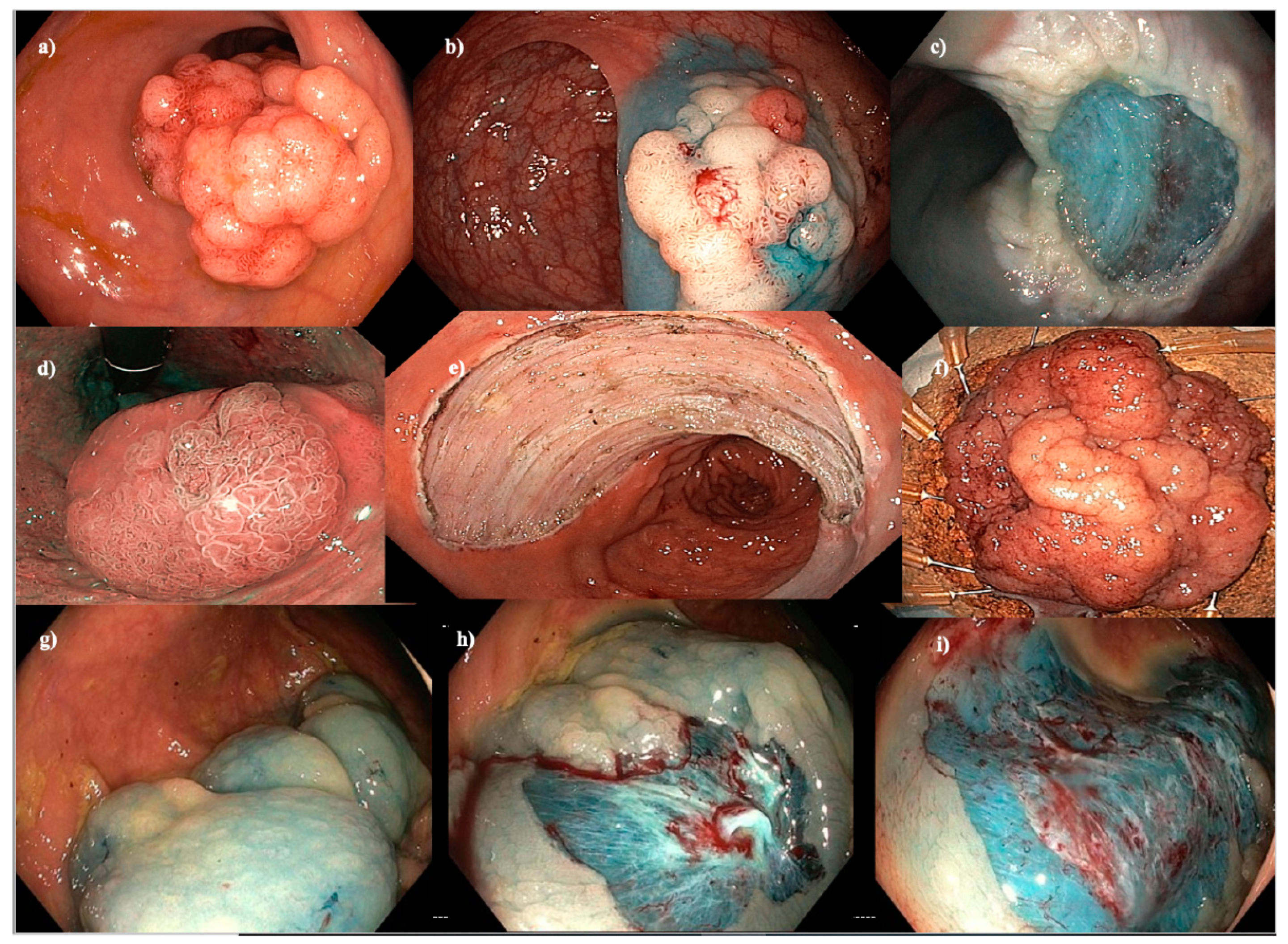 Cancers 15 03805 g001 Cancers 15 03805 g001