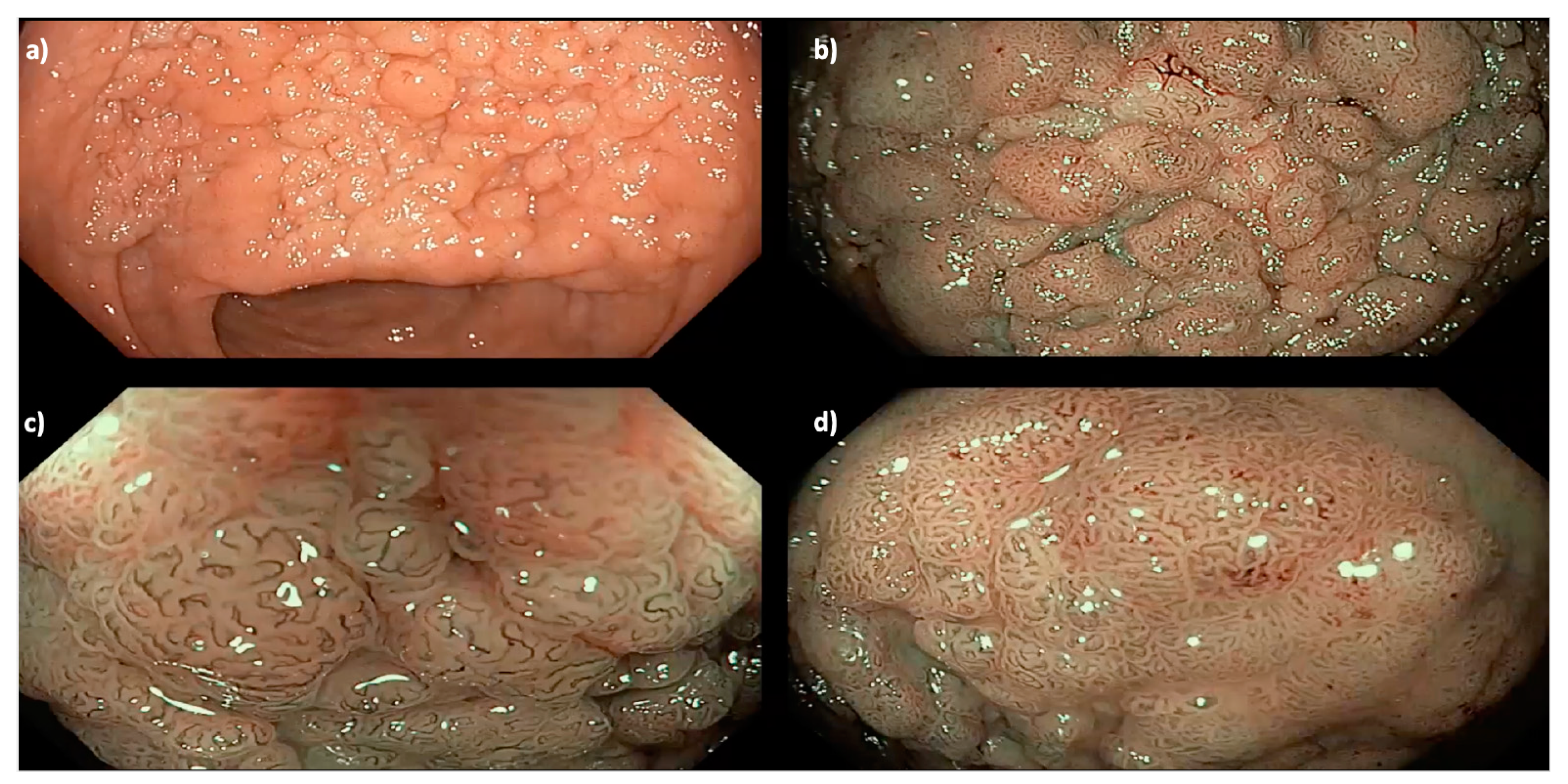 Cancers 15 03805 g002 Cancers 15 03805 g002