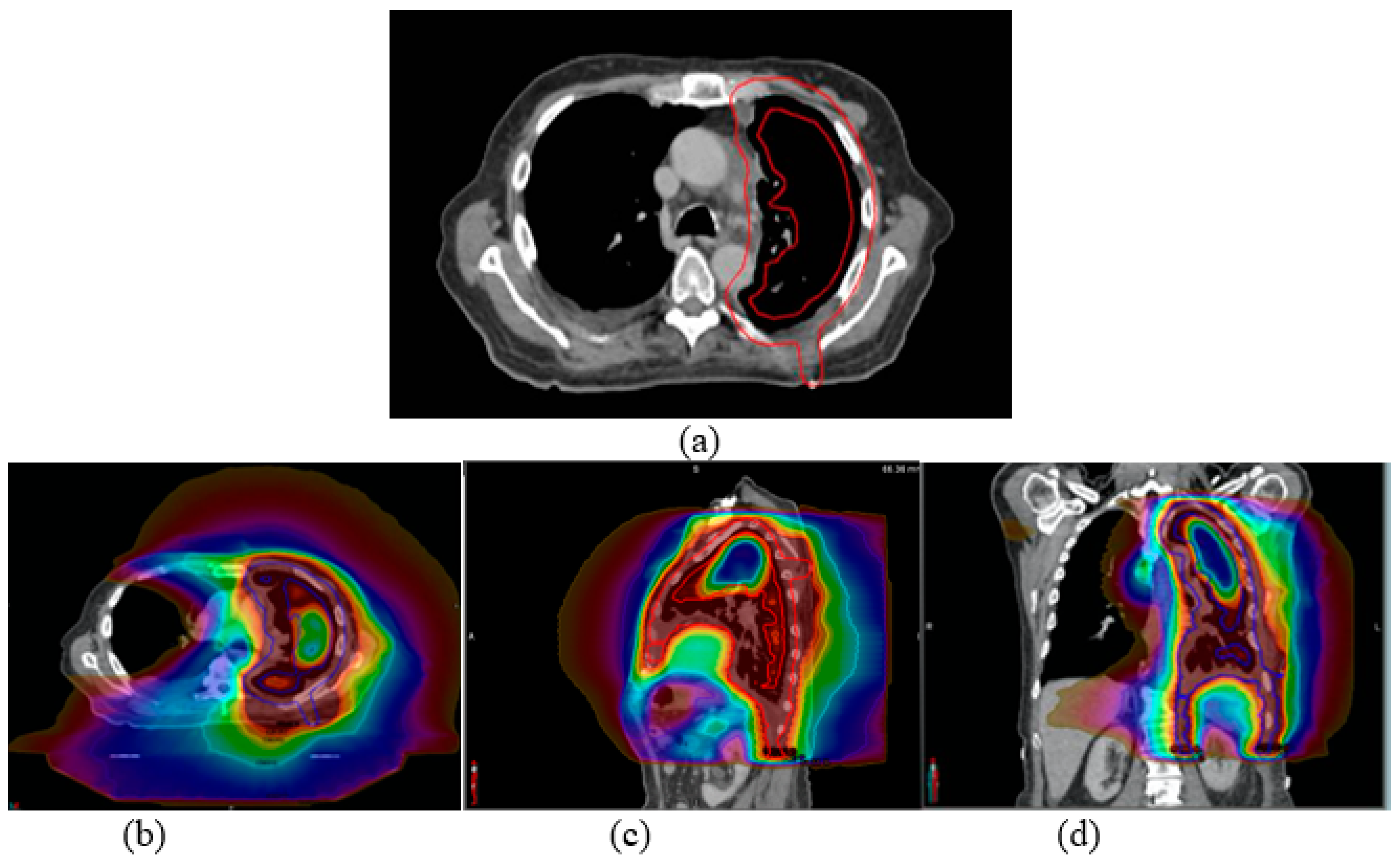 Cancers 15 03916 g001