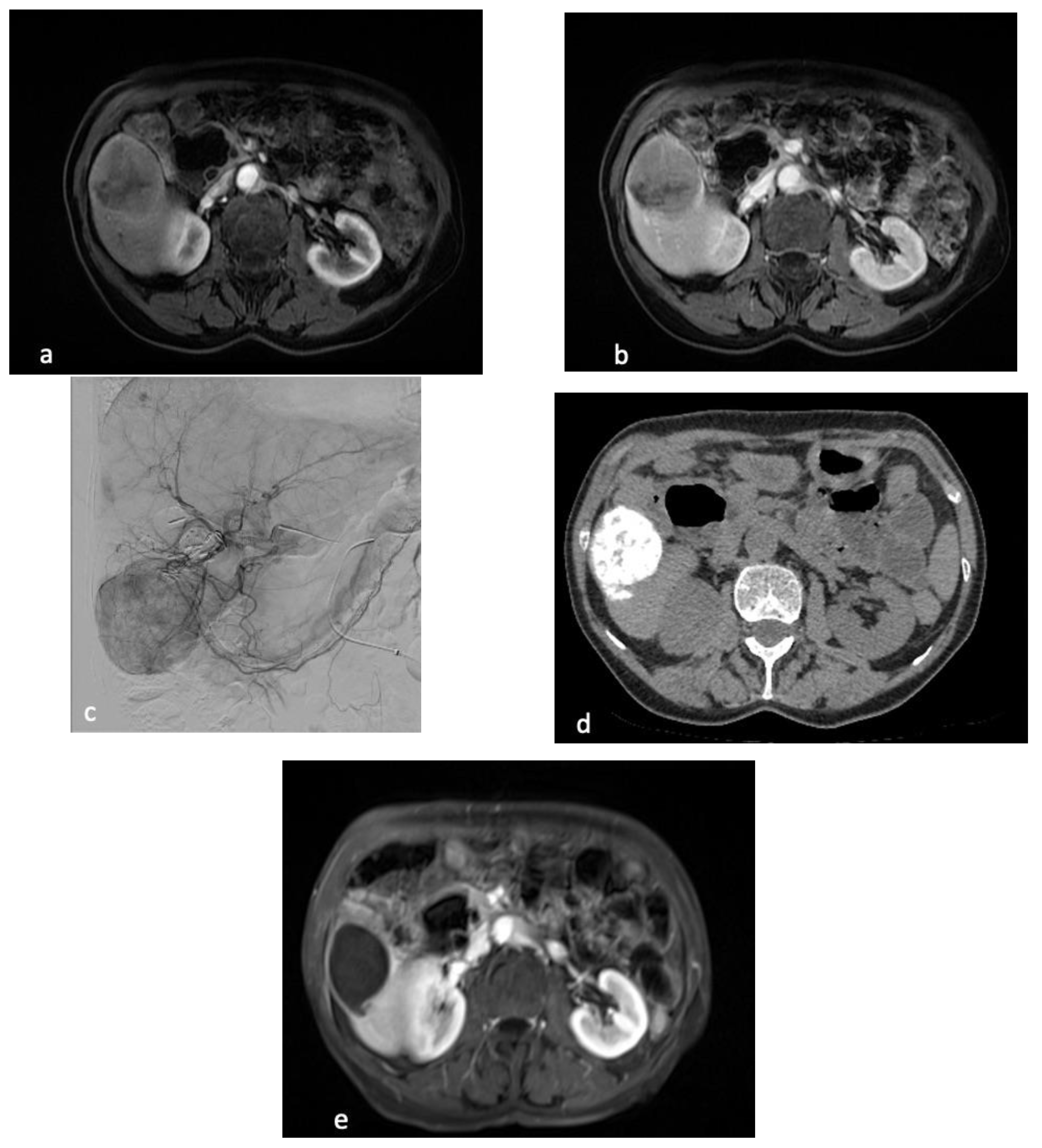 Cancers 15 04021 g005