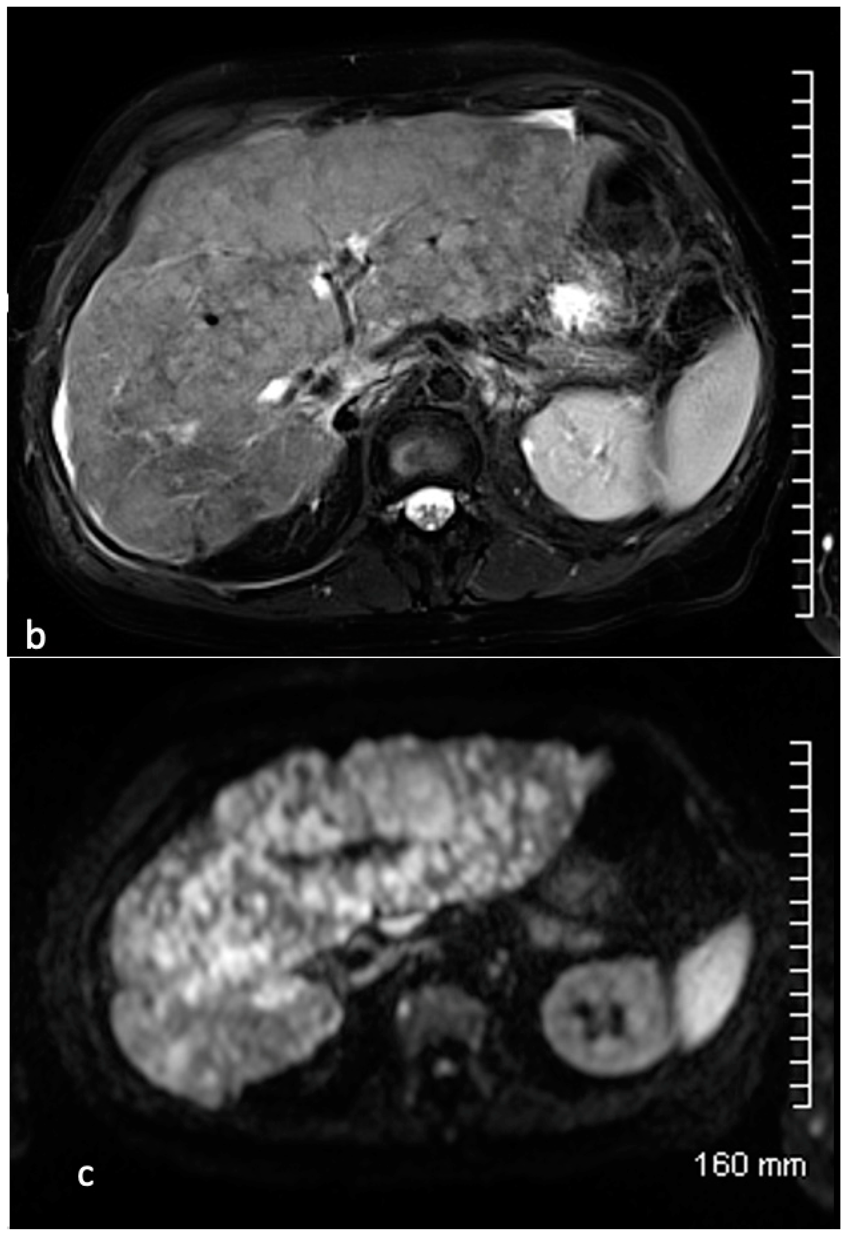 Cancers 15 04021 g006b