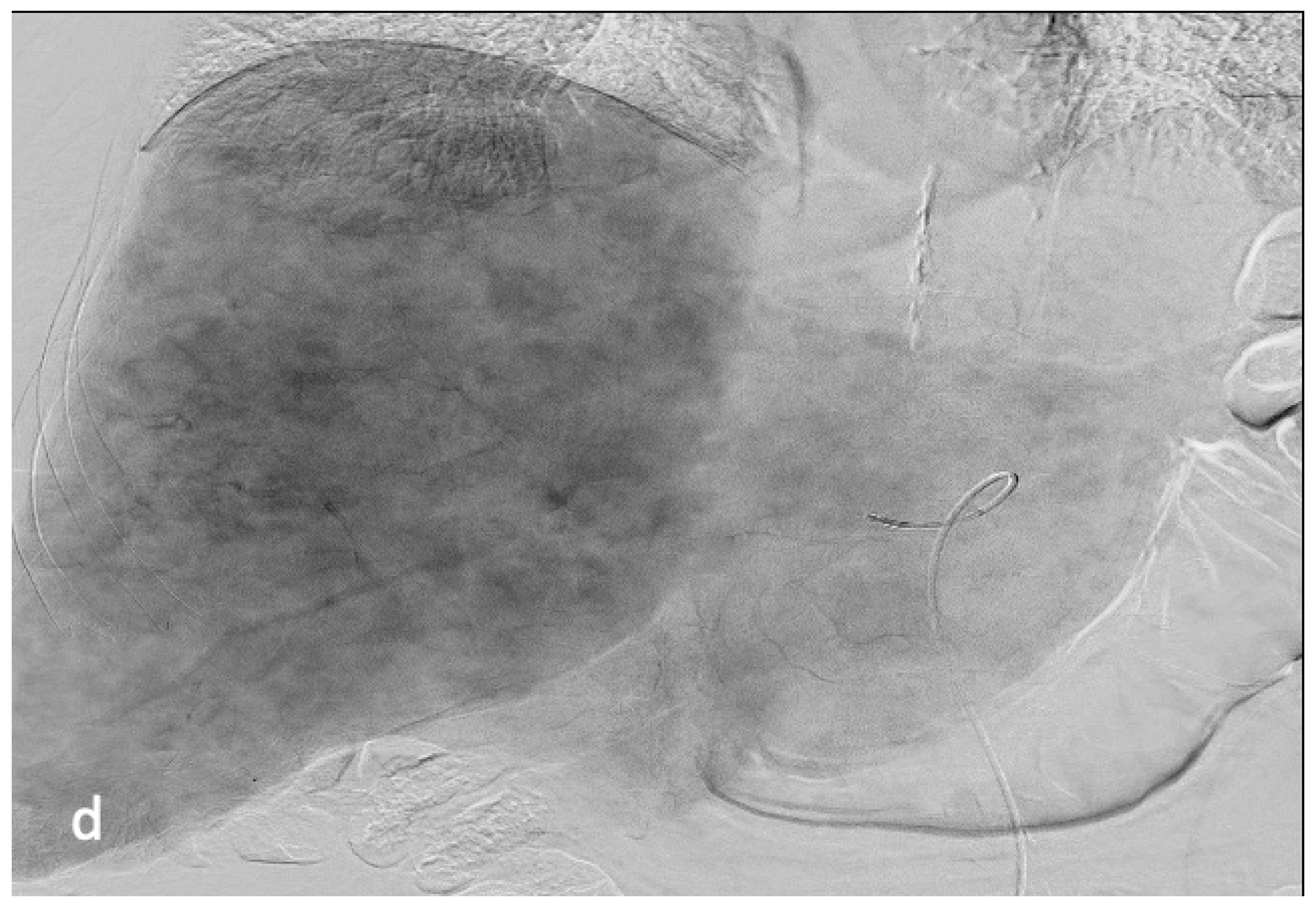 Cancers 15 04021 g006c