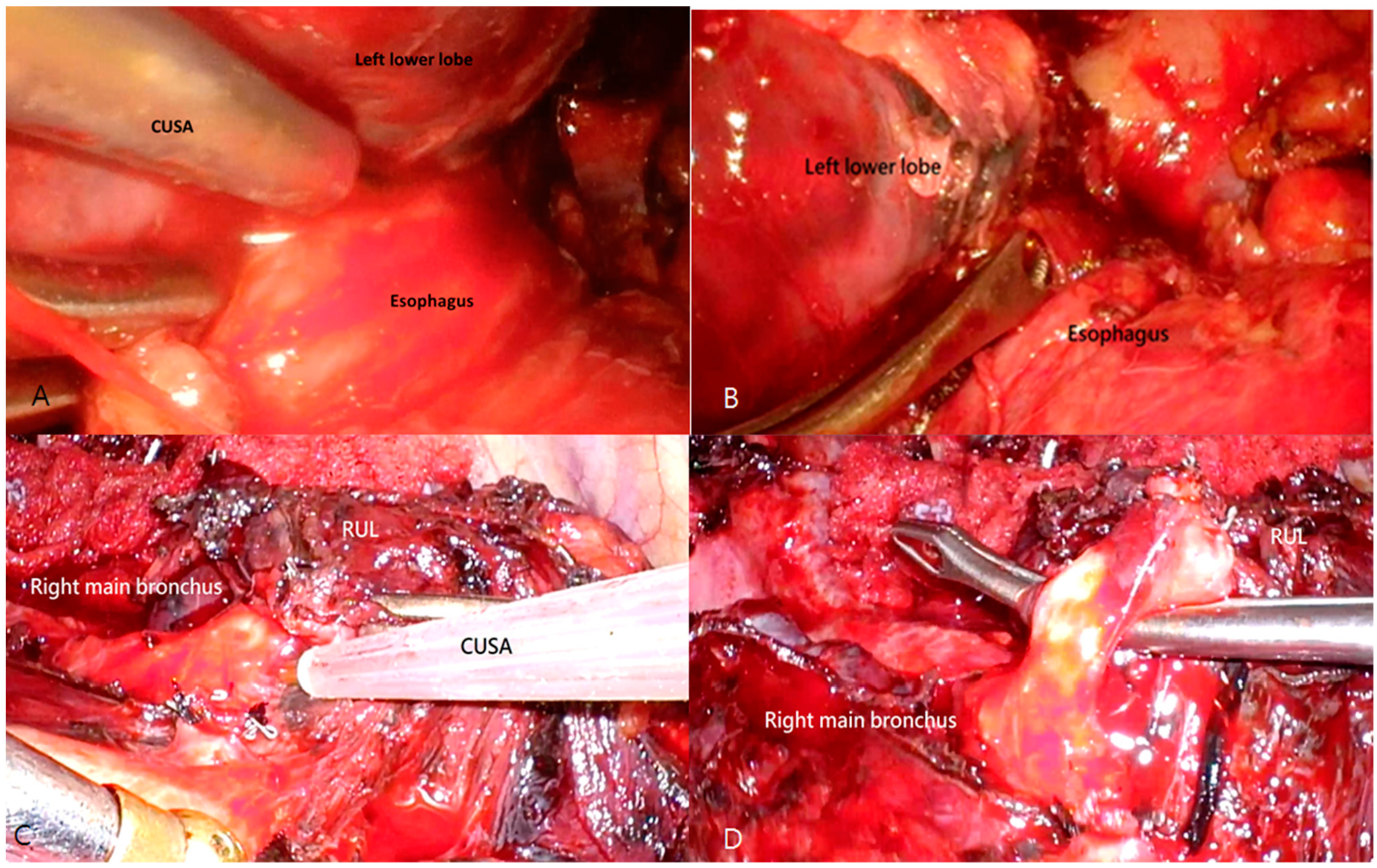 Cancers 15 04069 g001