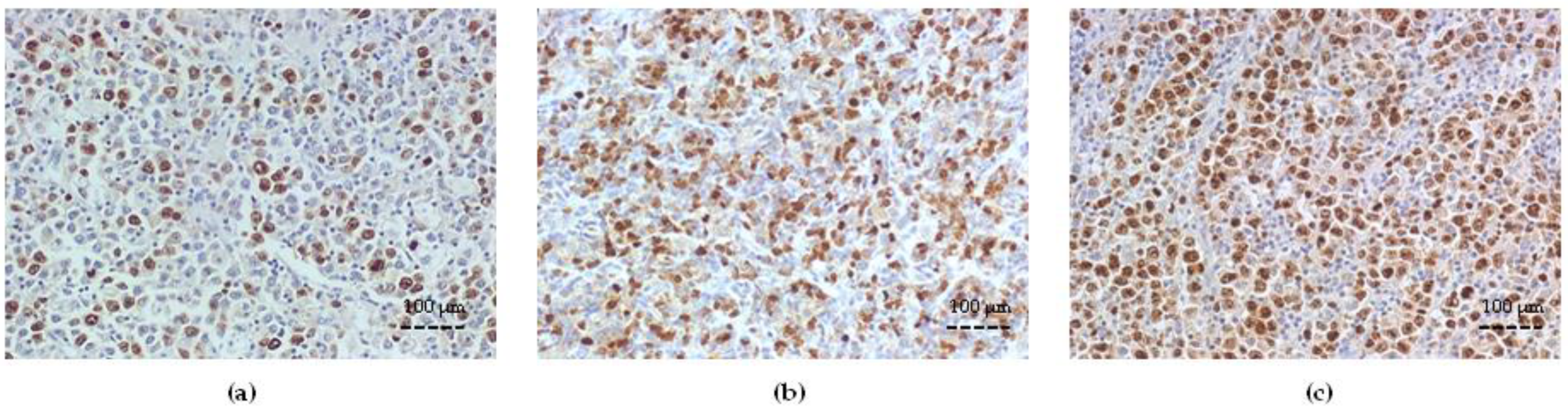 Cancers 15 04106 g004