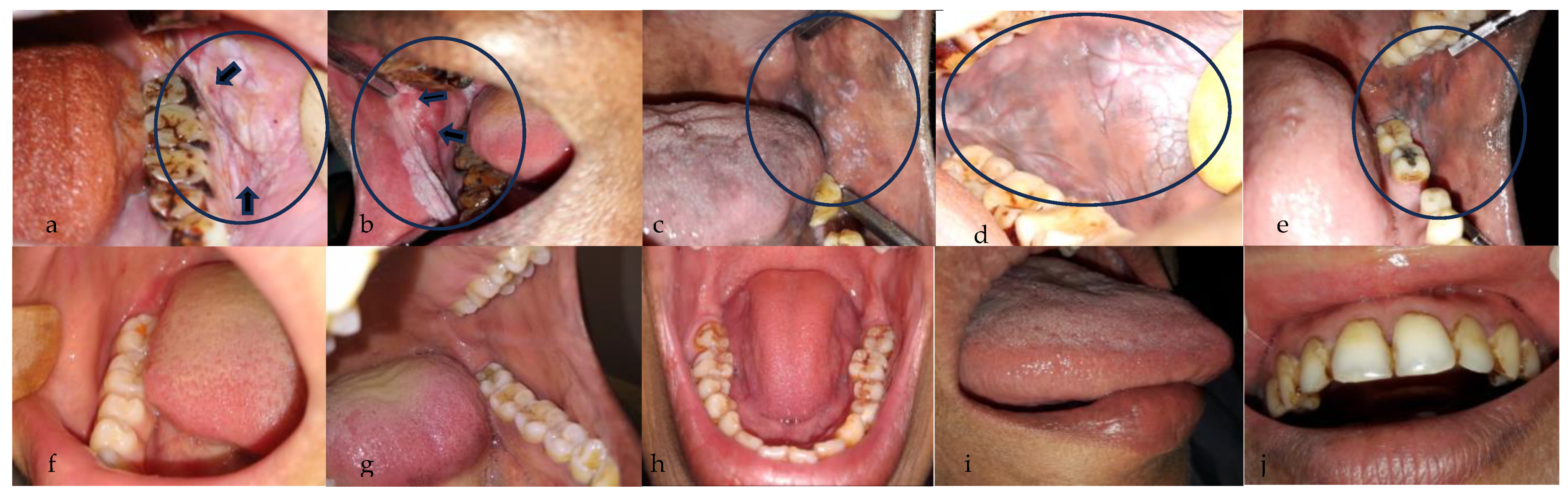 Cancers 15 04120 g001