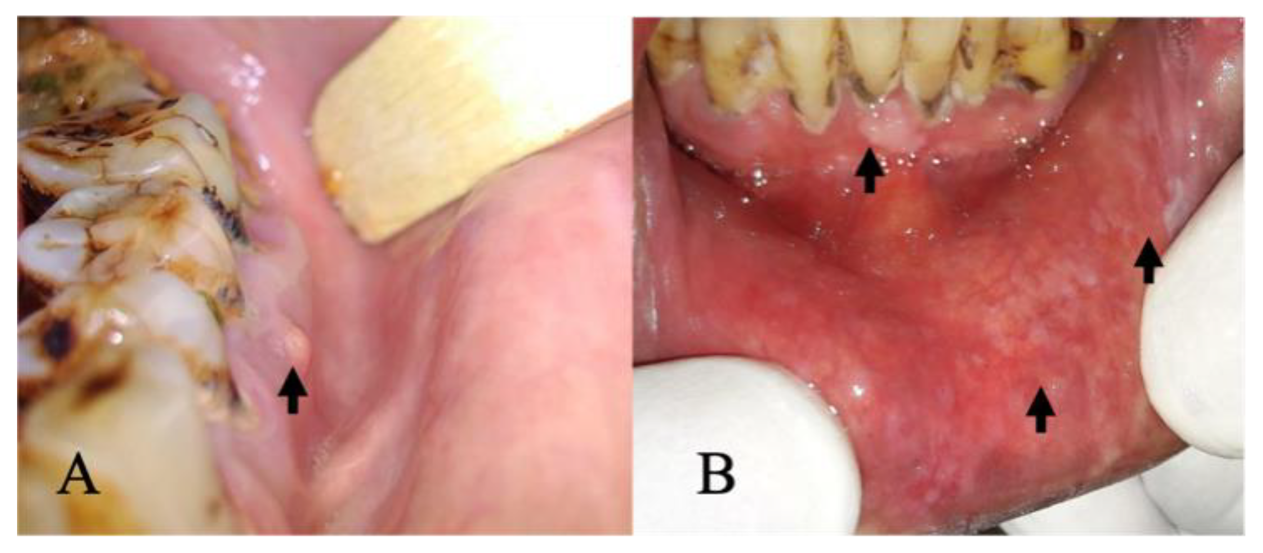 Cancers 15 04120 g005