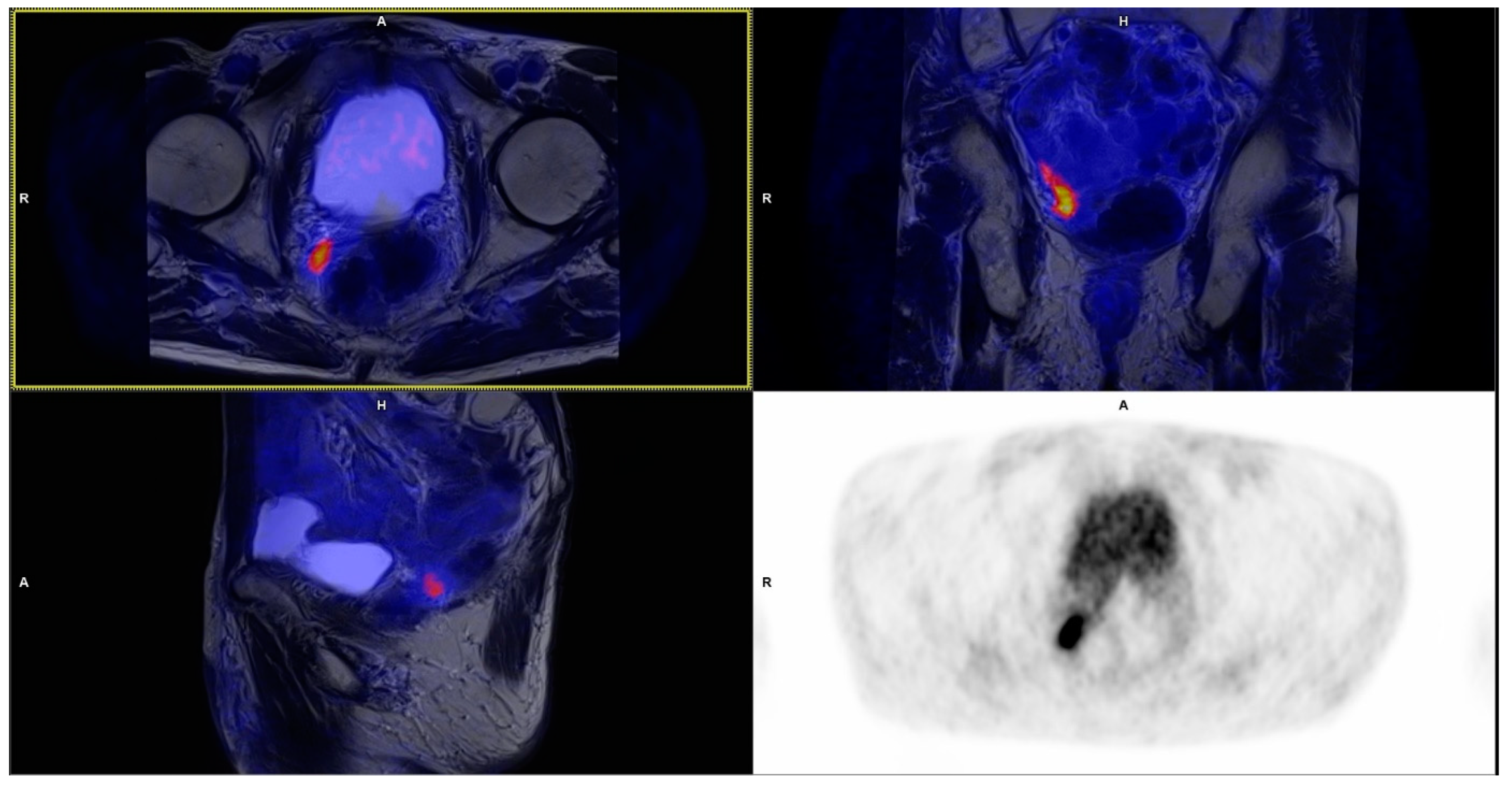 Cancers 15 04185 g001