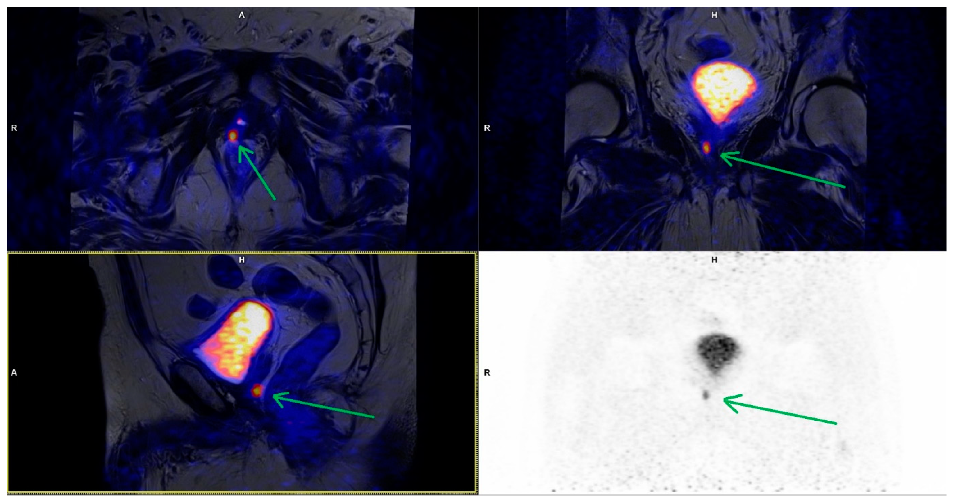 Cancers 15 04185 g002