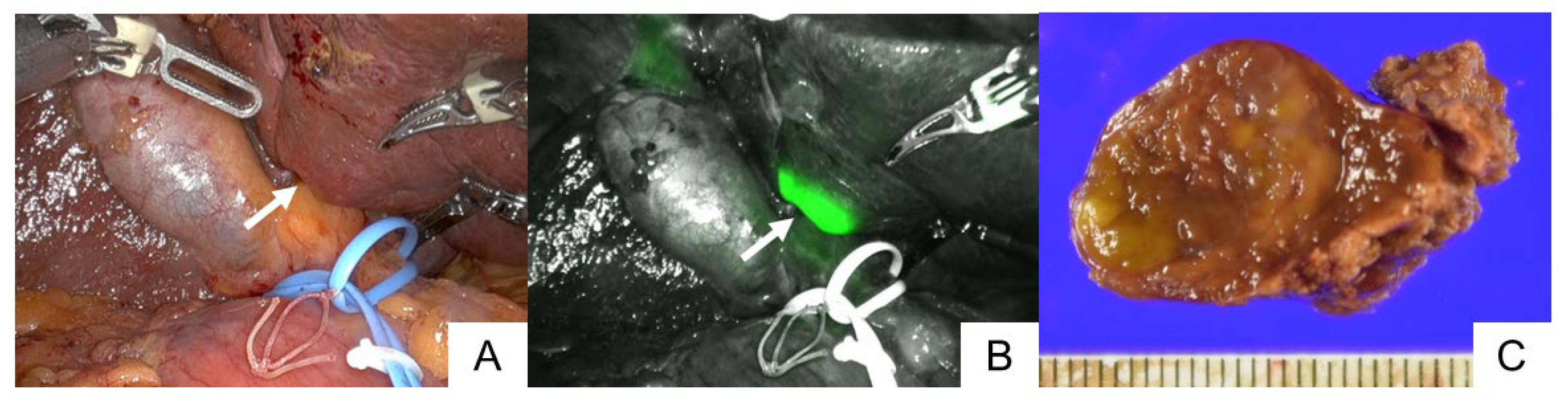 Cancers 15 04205 g001