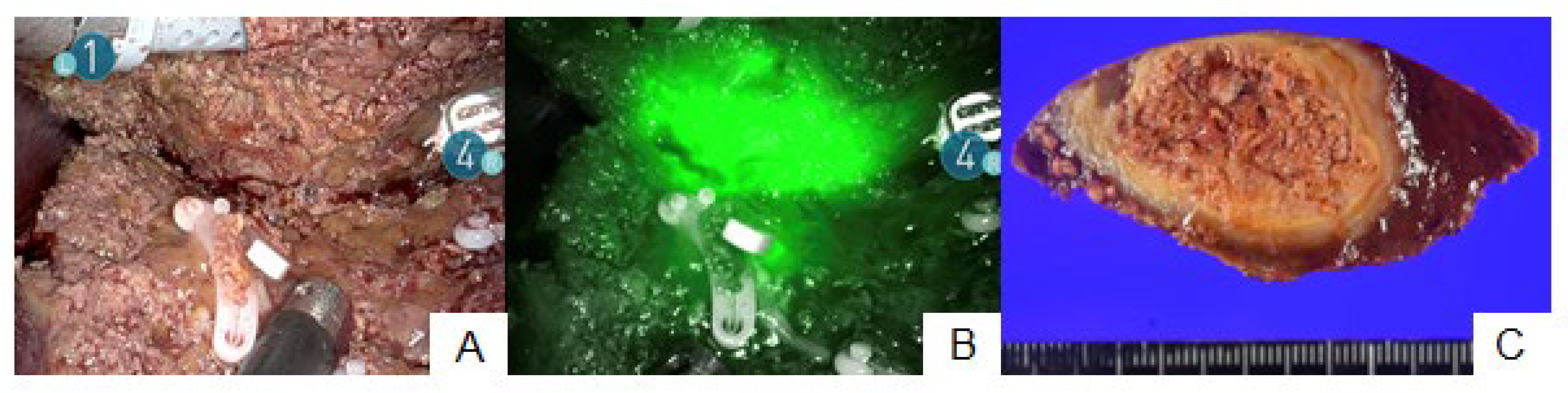 Cancers 15 04205 g002