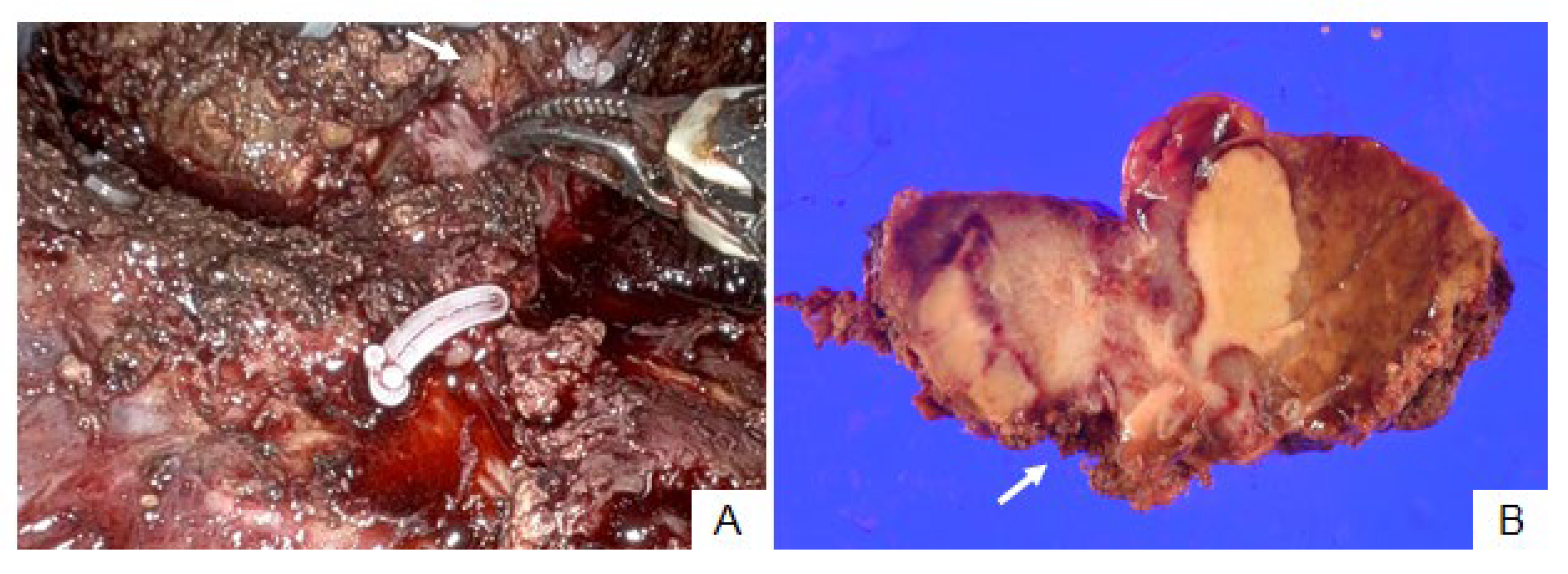 Cancers 15 04205 g003