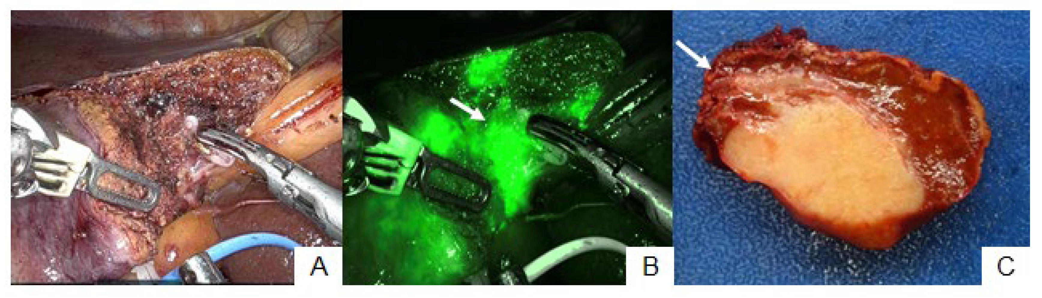 Cancers 15 04205 g004