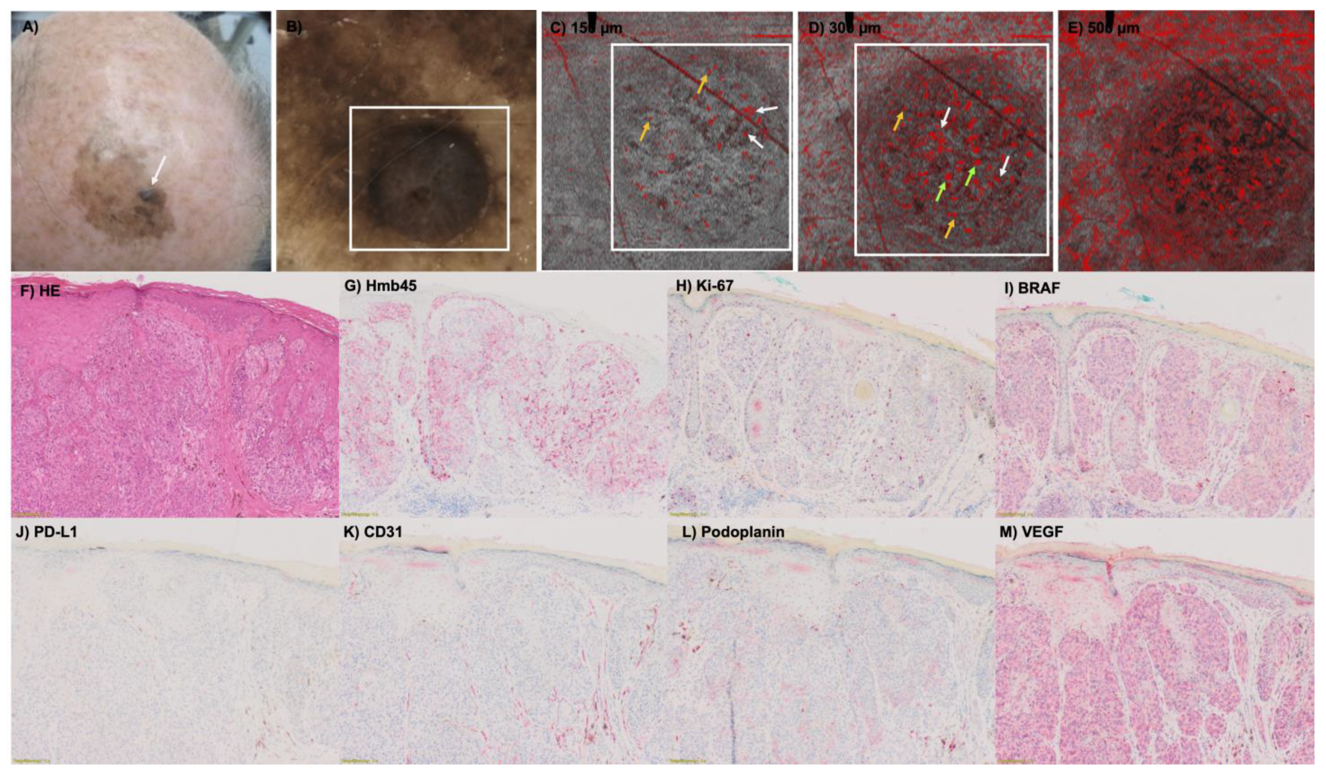 Cancers 15 04222 g002