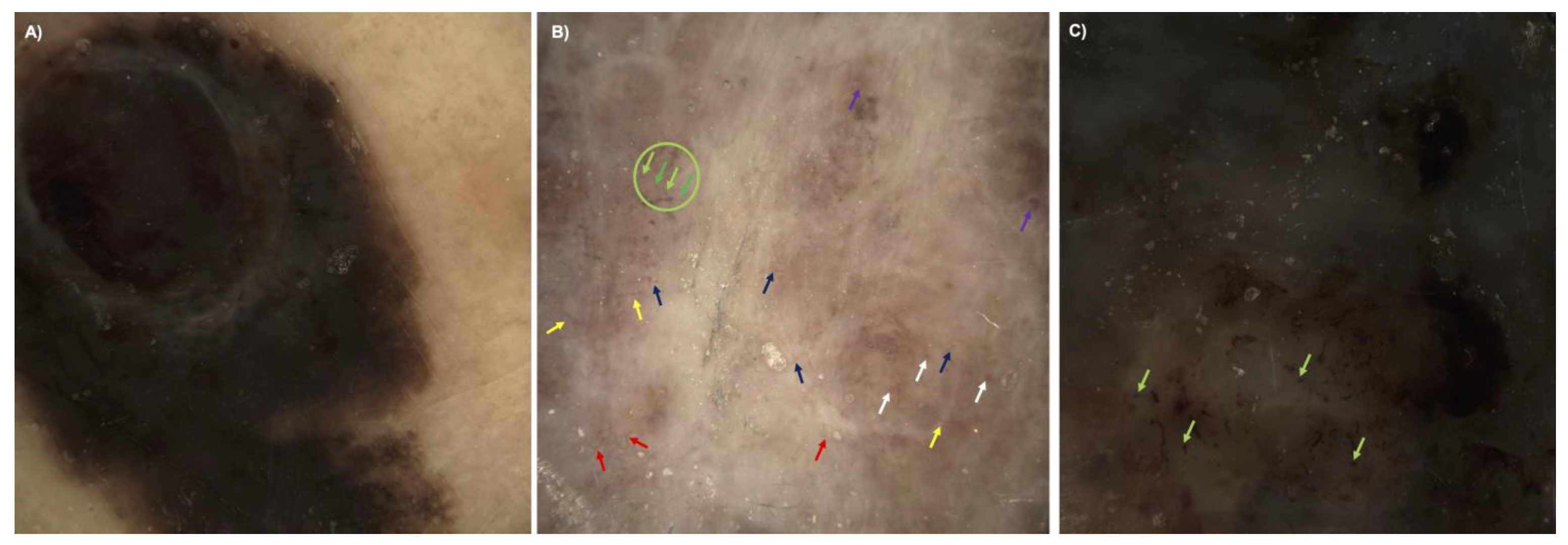 Cancers 15 04222 g006