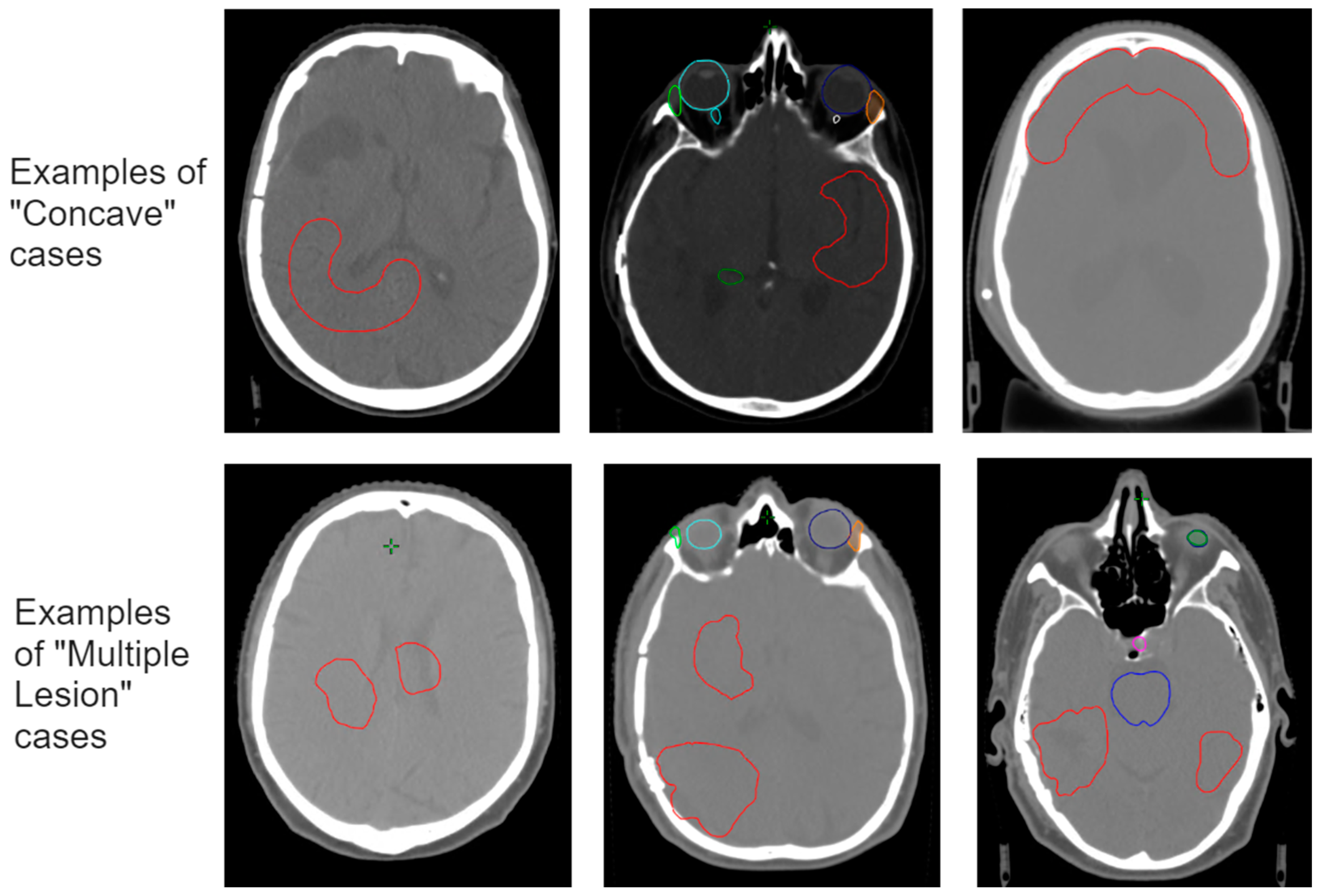 Cancers 15 04226 g002