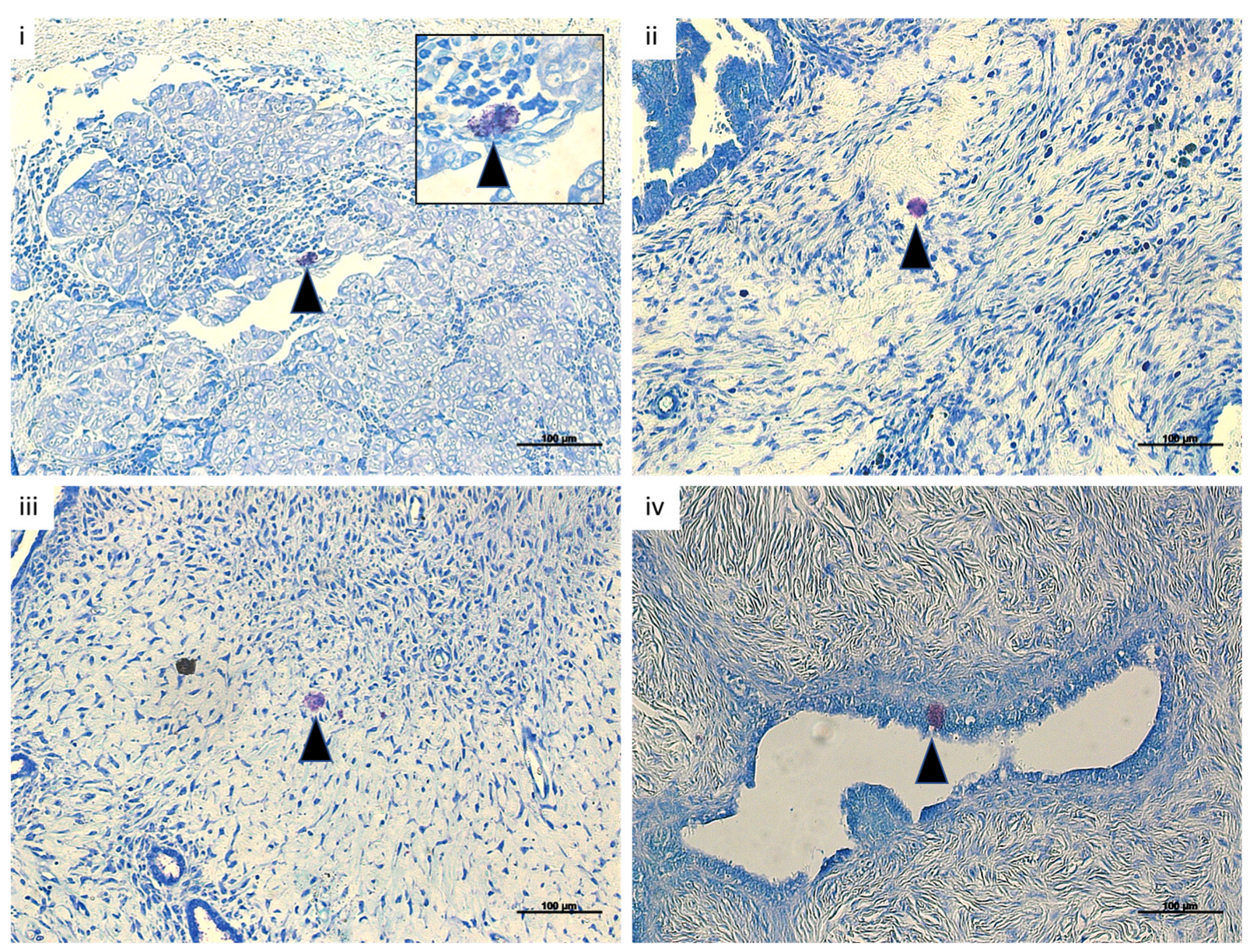 Cancers 15 04278 g001