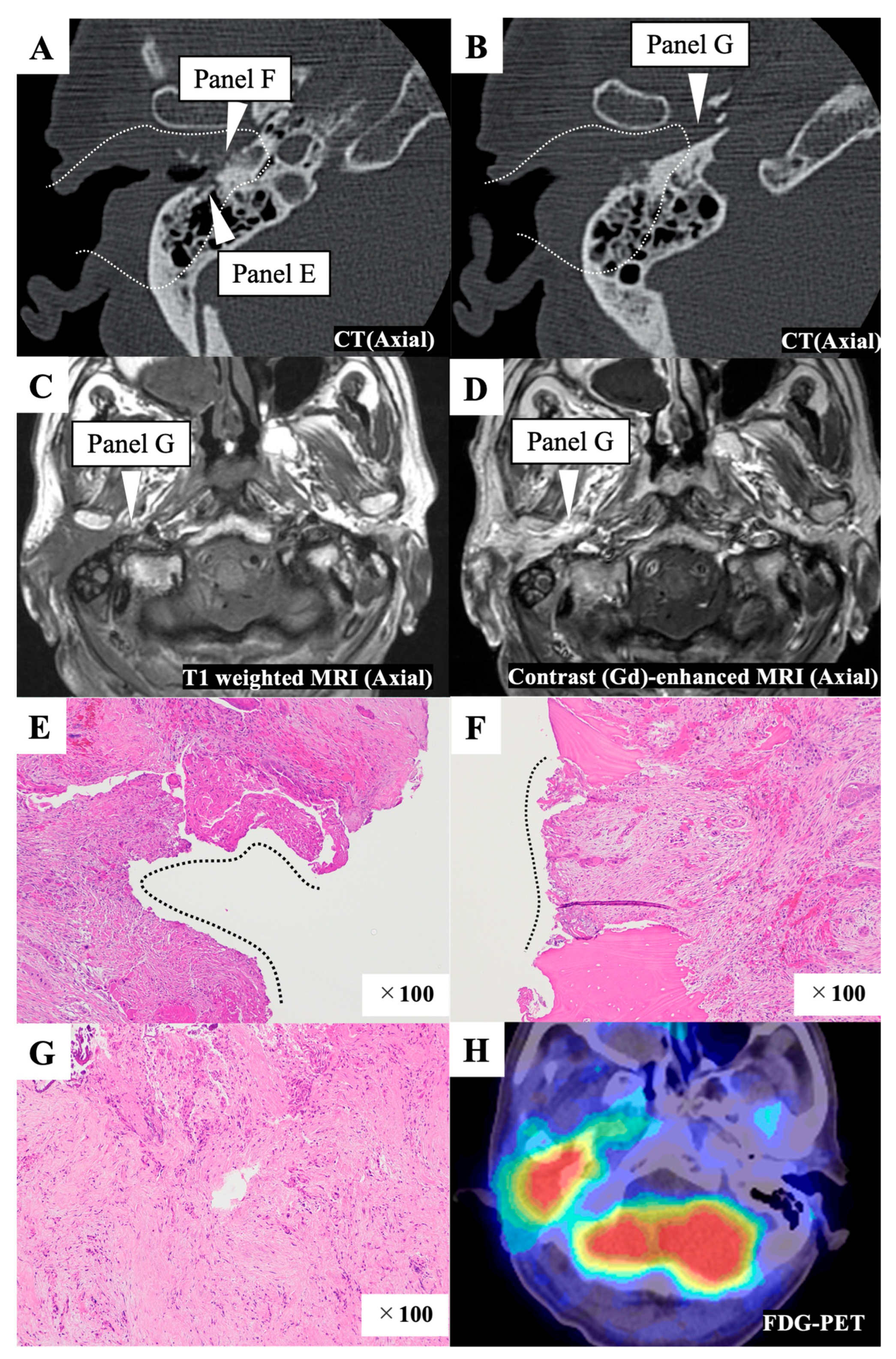 Cancers 15 04289 g002