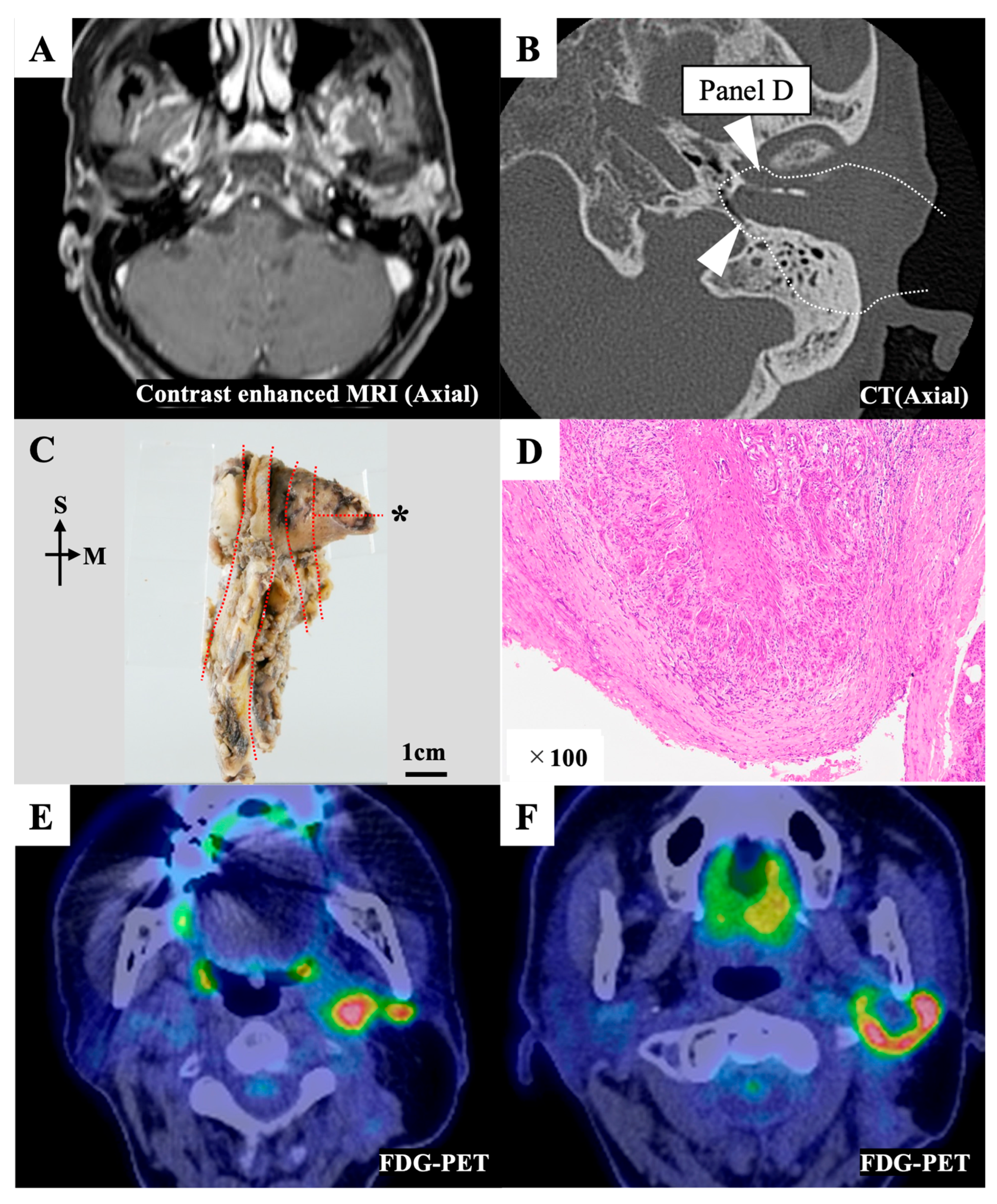 Cancers 15 04289 g003