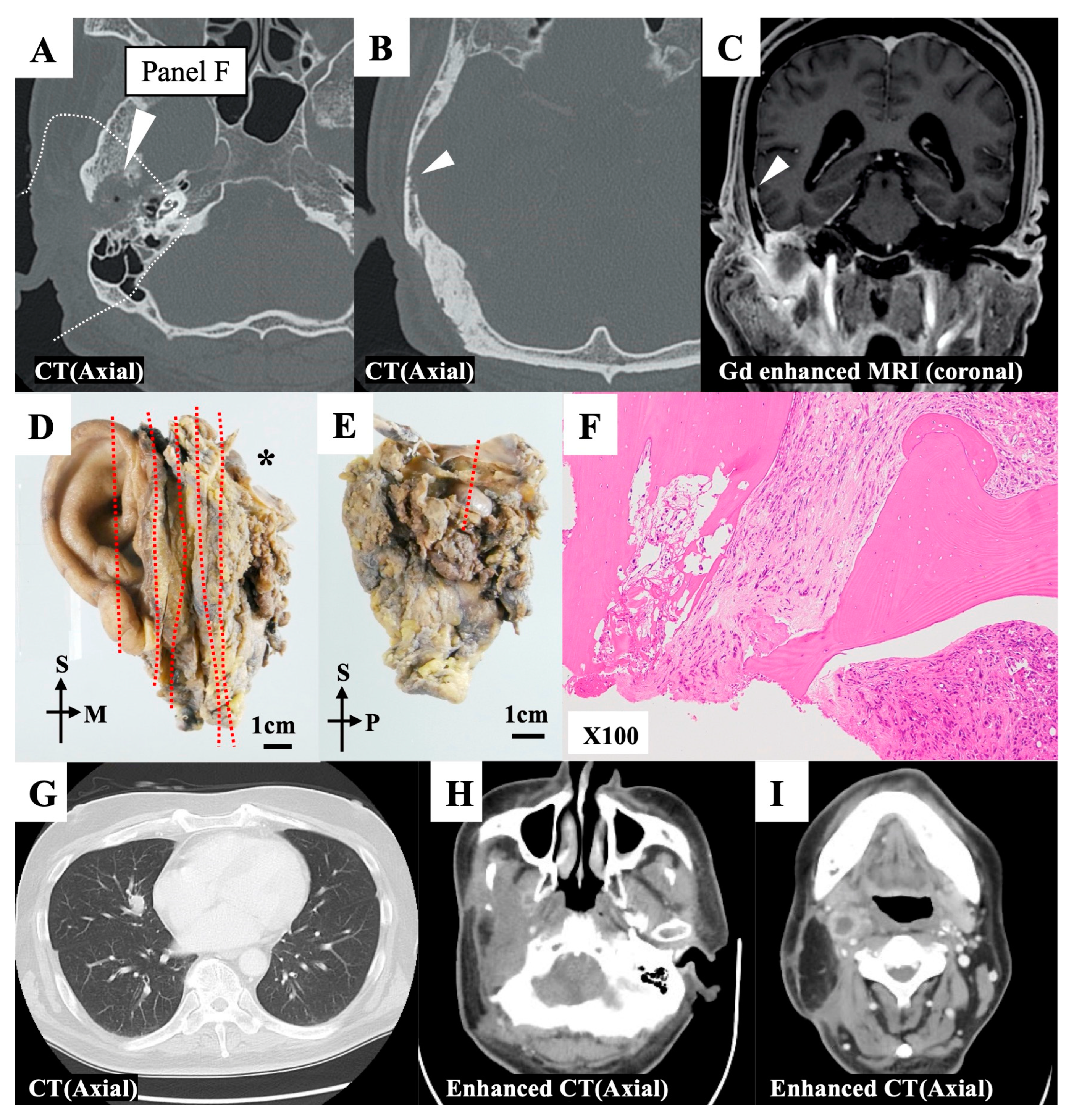 Cancers 15 04289 g004