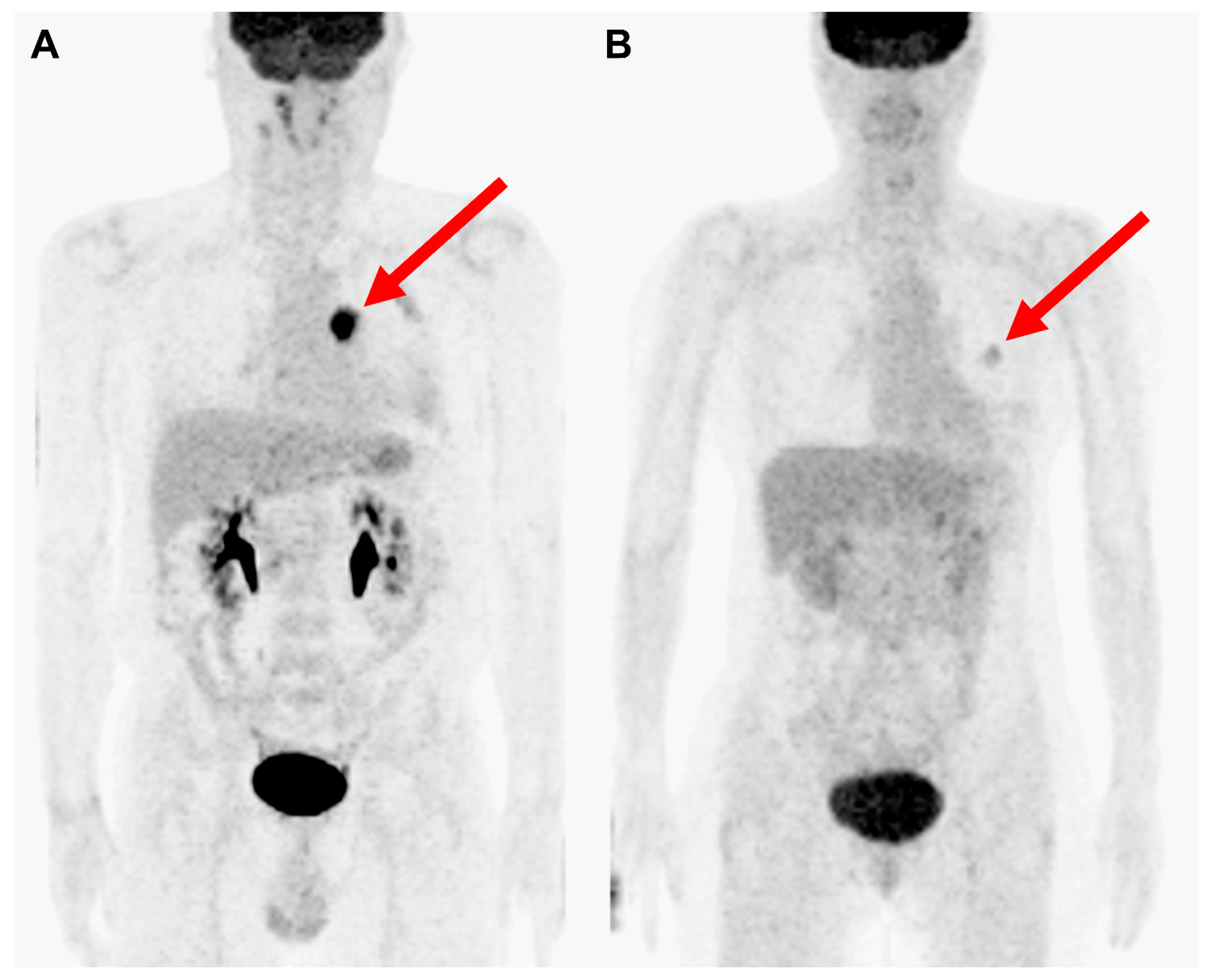 Cancers 15 04380 g006