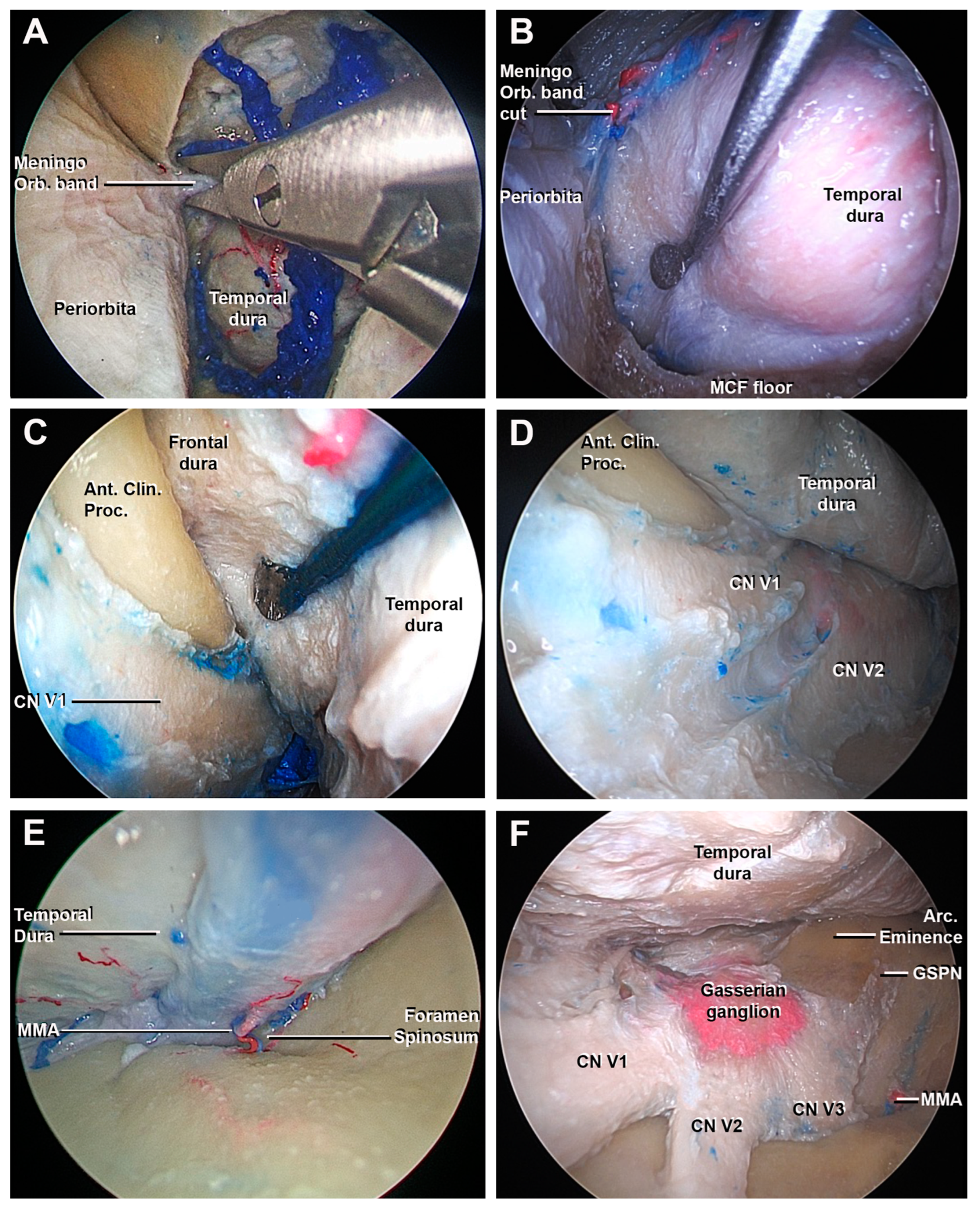 Cancers 15 04435 g005