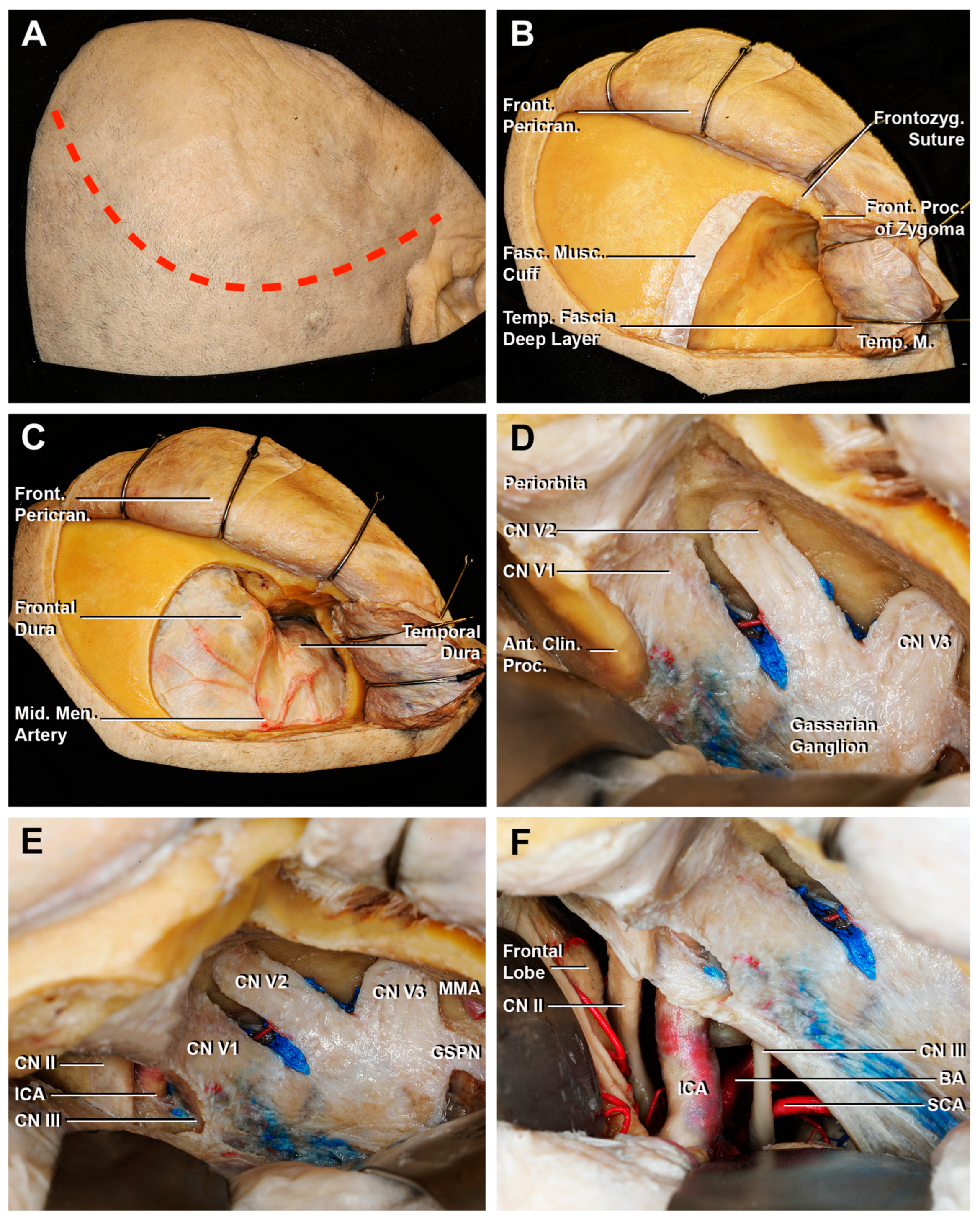Cancers 15 04435 g008