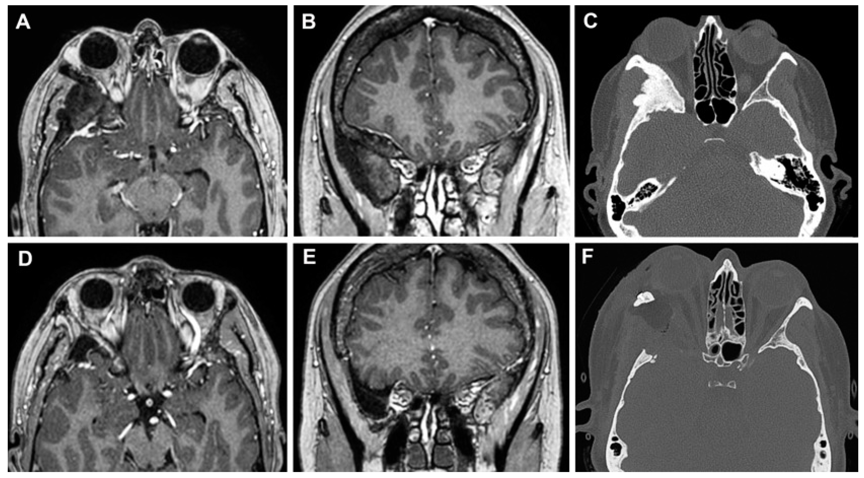 Cancers 15 04435 g010