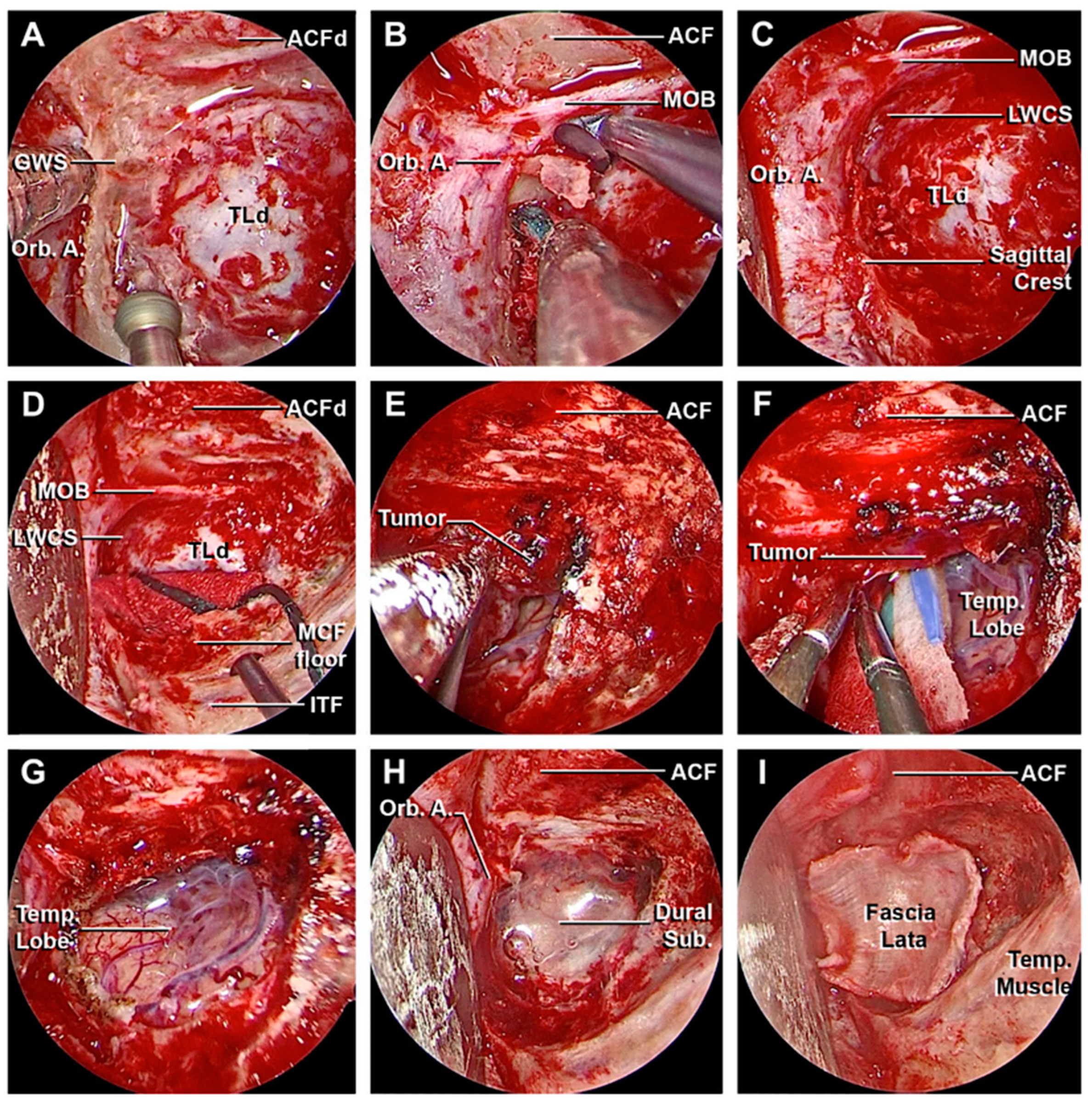 Cancers 15 04435 g012