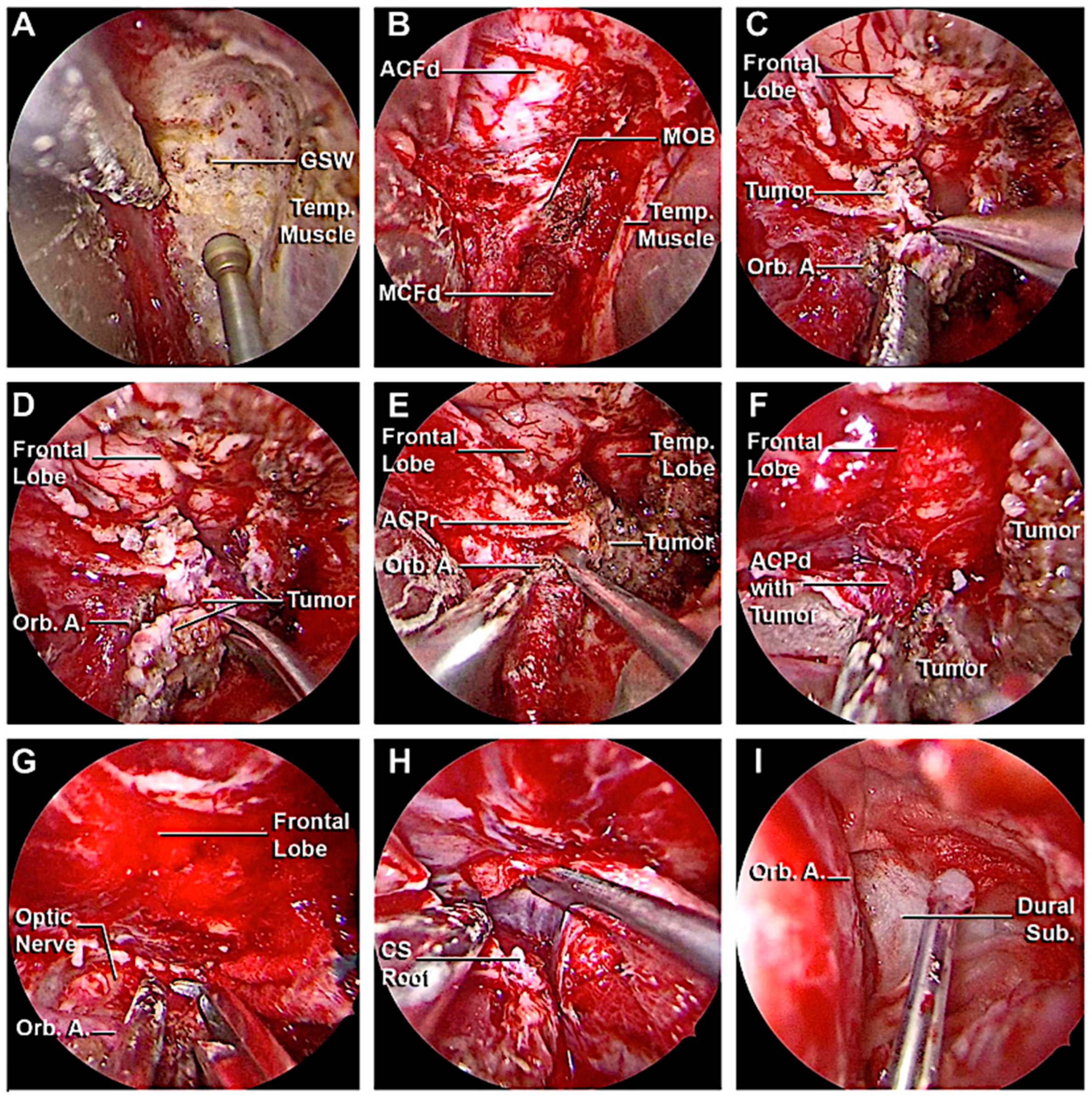 Cancers 15 04435 g014