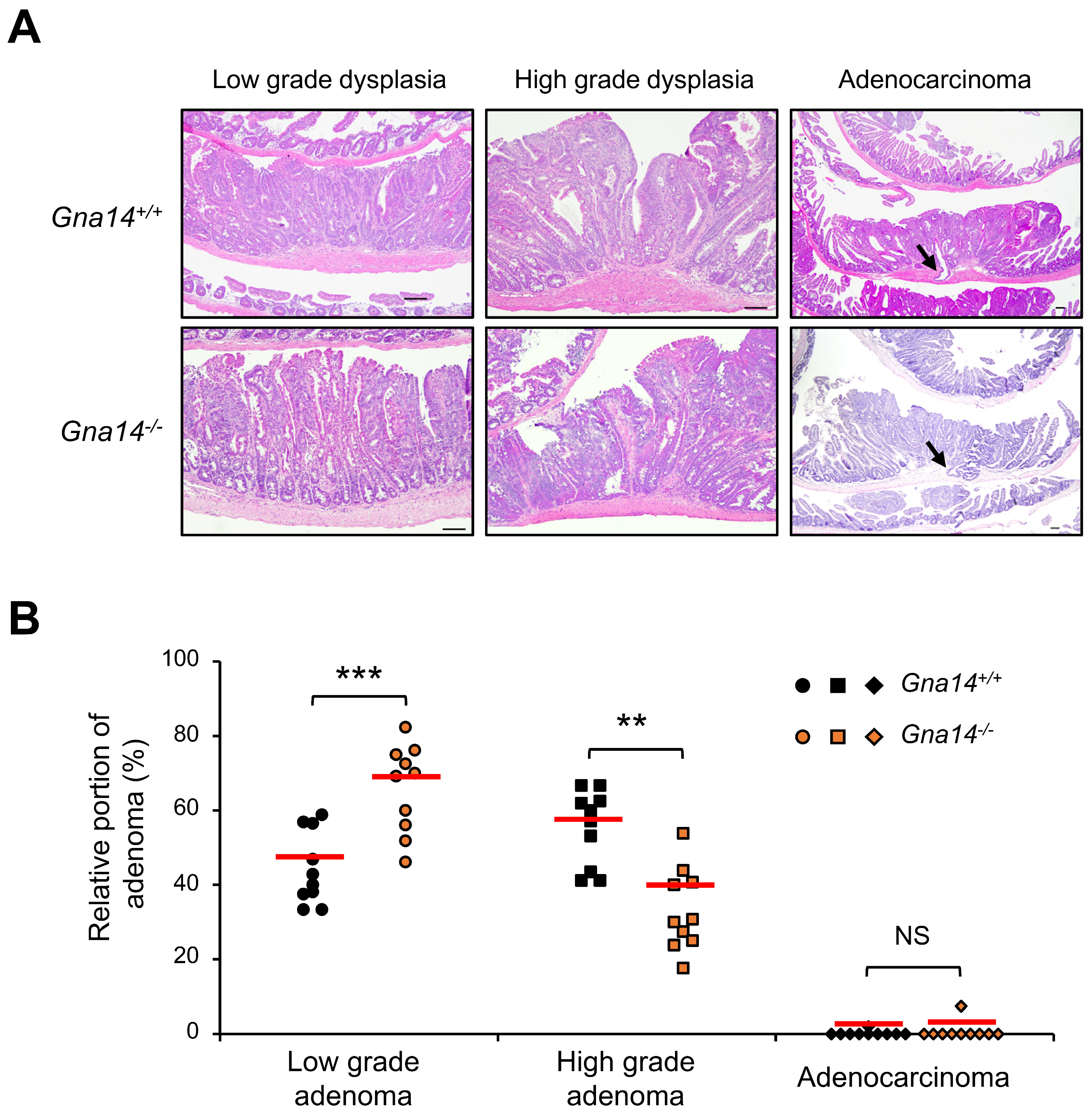 Cancers 15 04572 g004