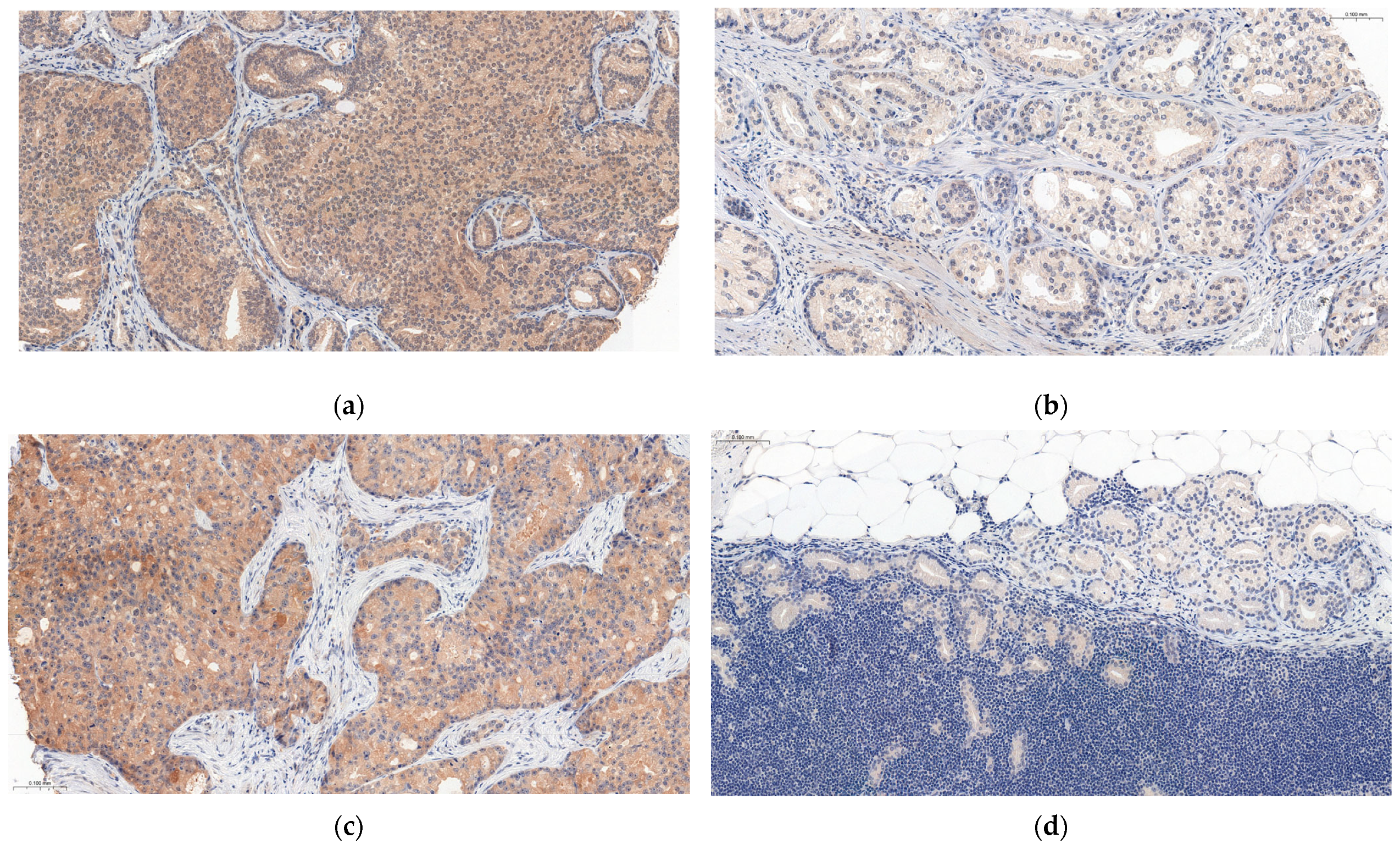 Cancers 15 04578 g003