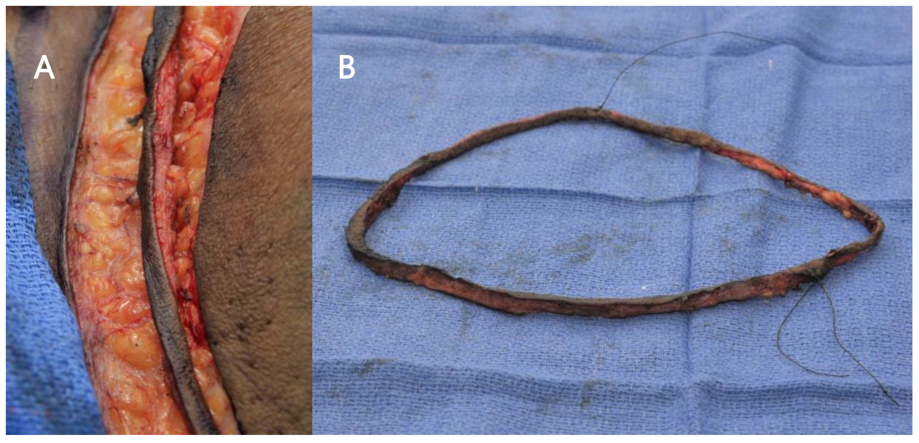 Cancers 15 04597 g001