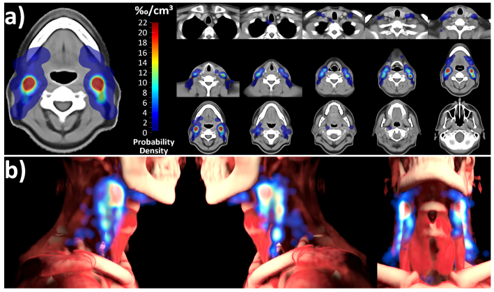 Cancers 15 04620 g004