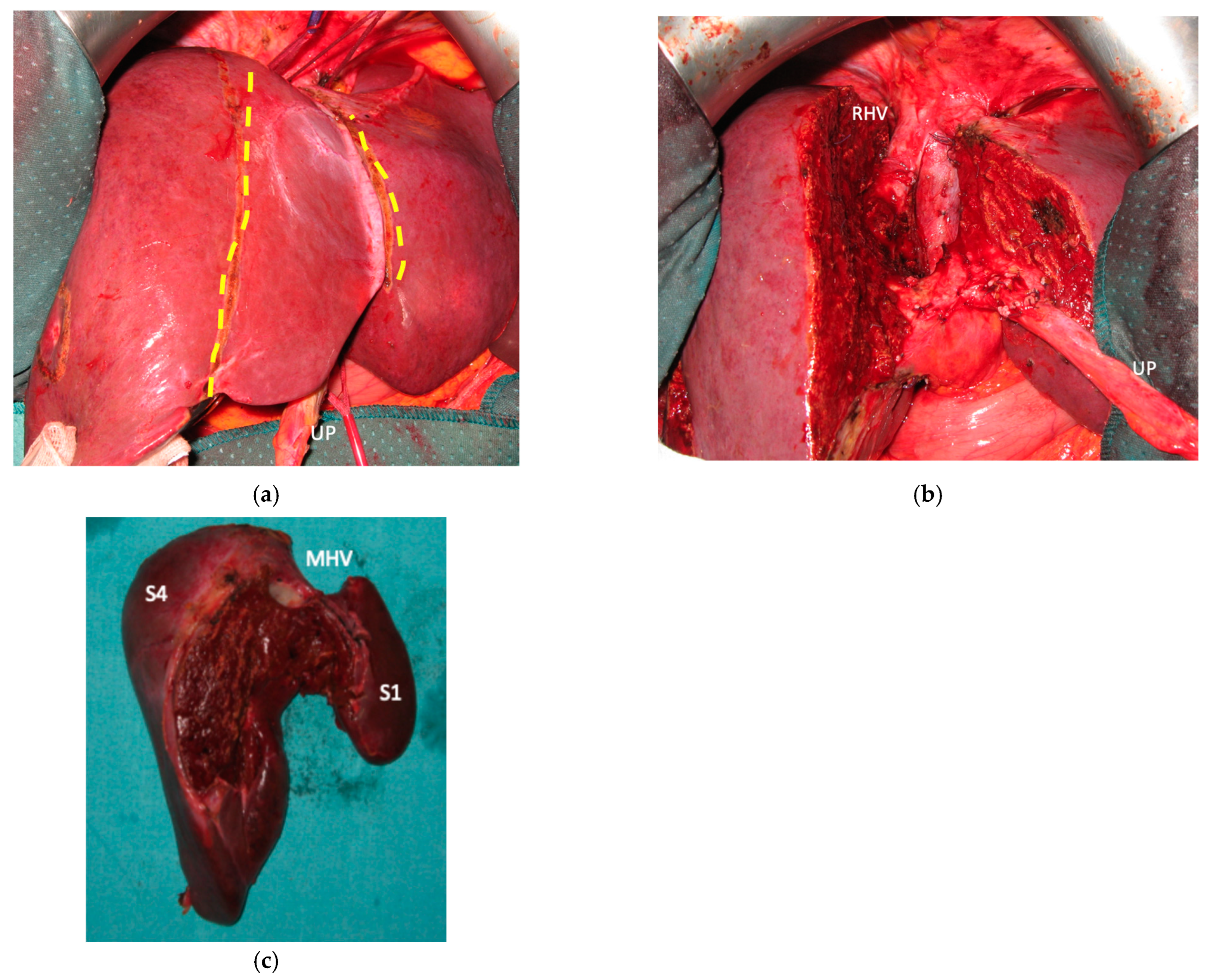 Cancers 15 04683 g004