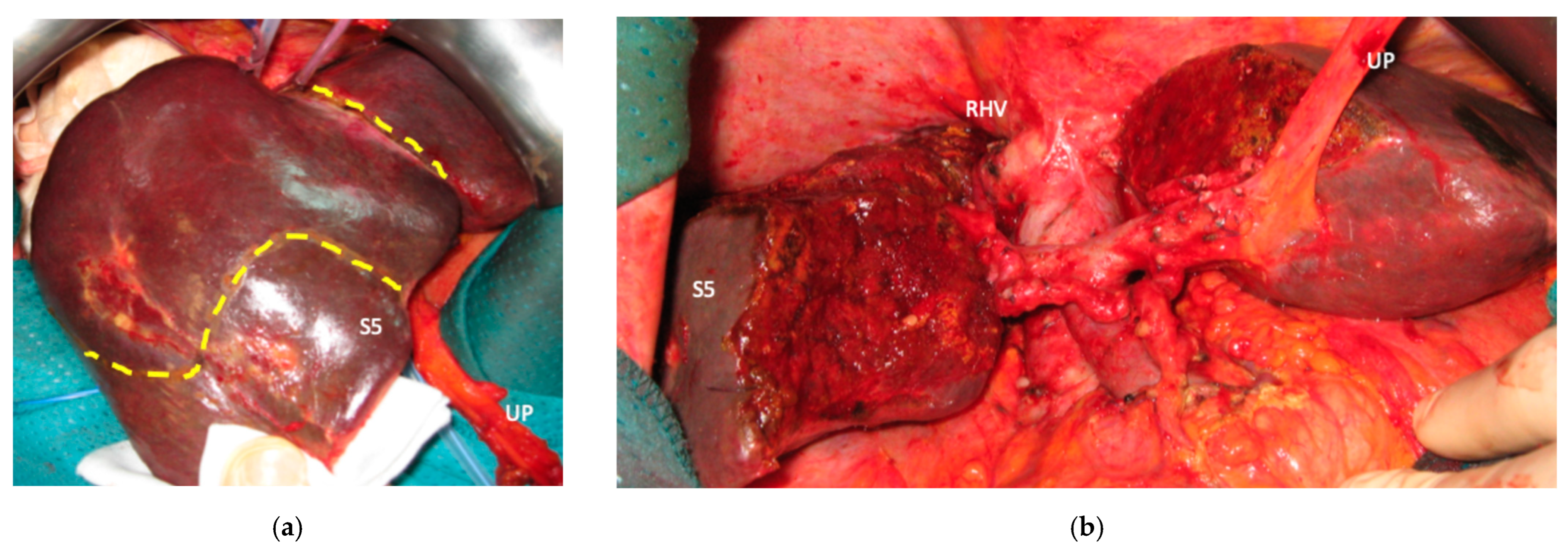 Cancers 15 04683 g005