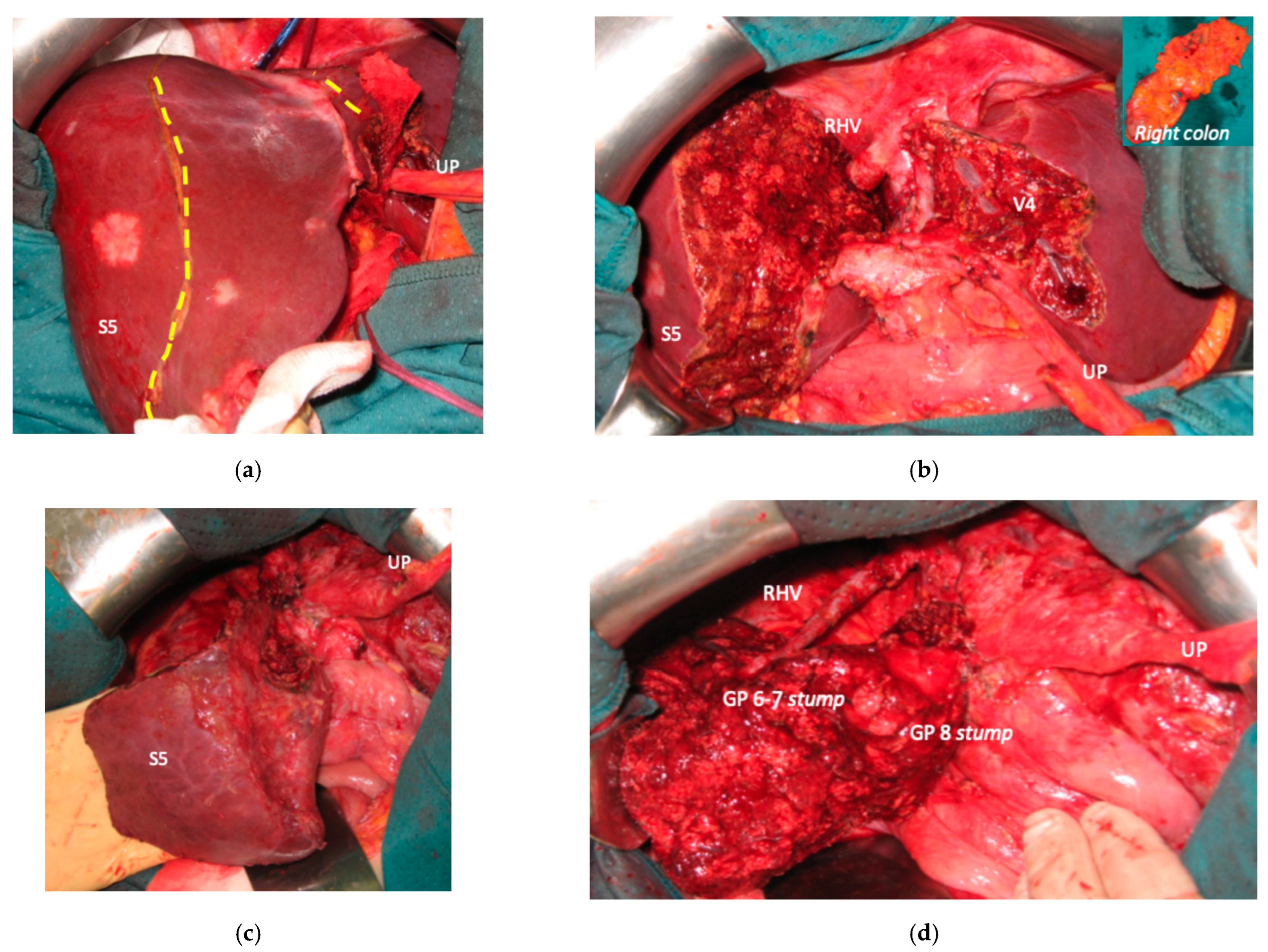 Cancers 15 04683 g007