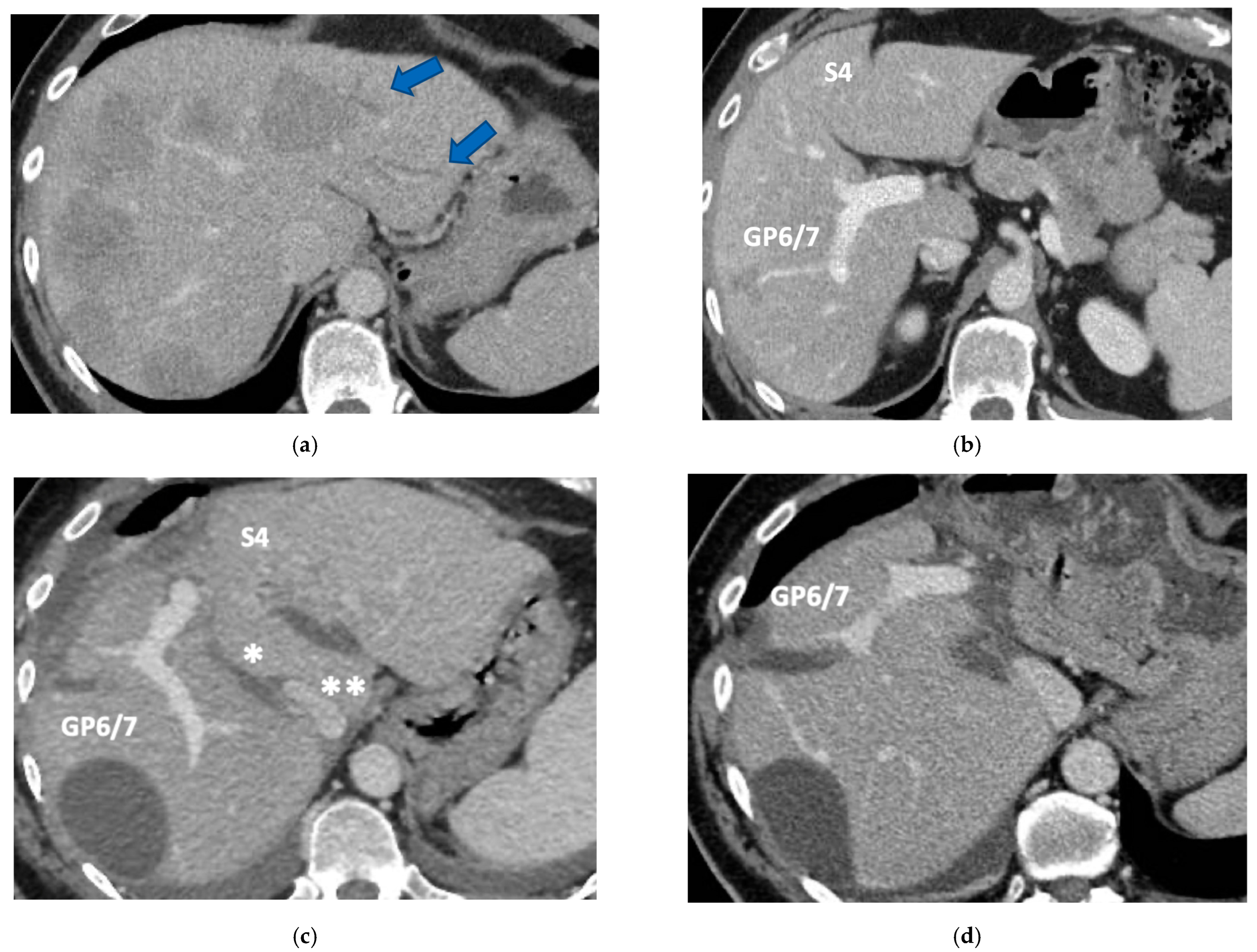 Cancers 15 04683 g009