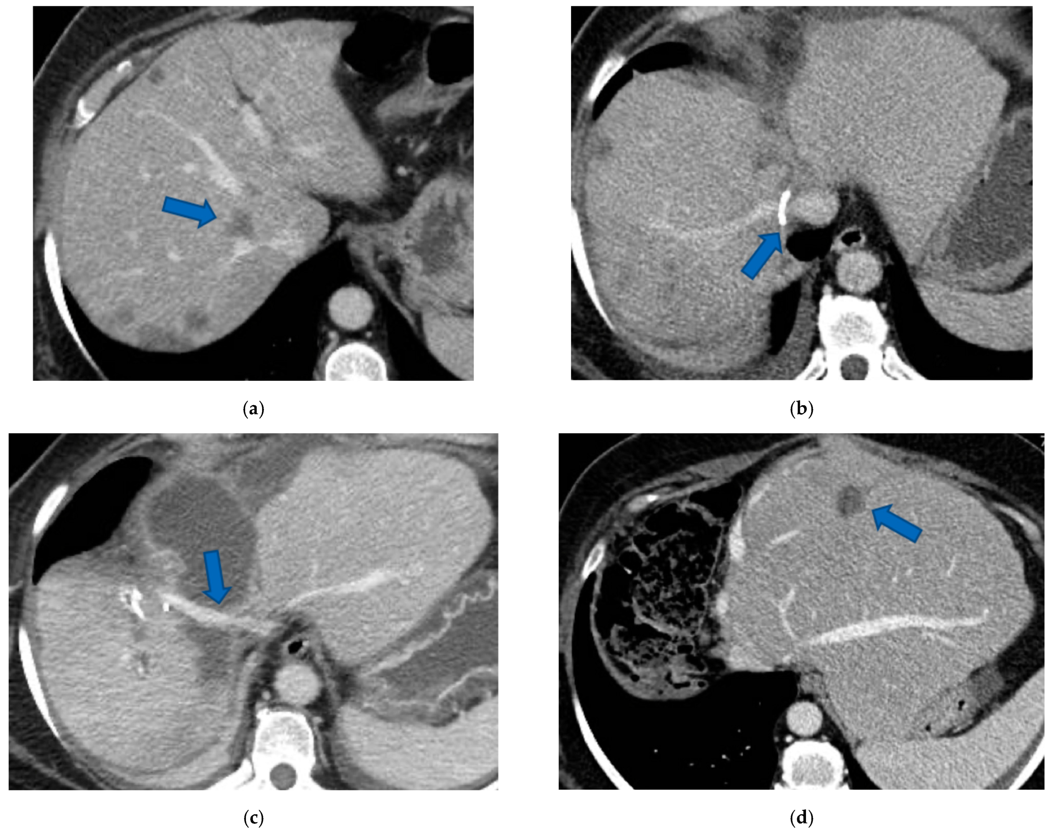 Cancers 15 04683 g010