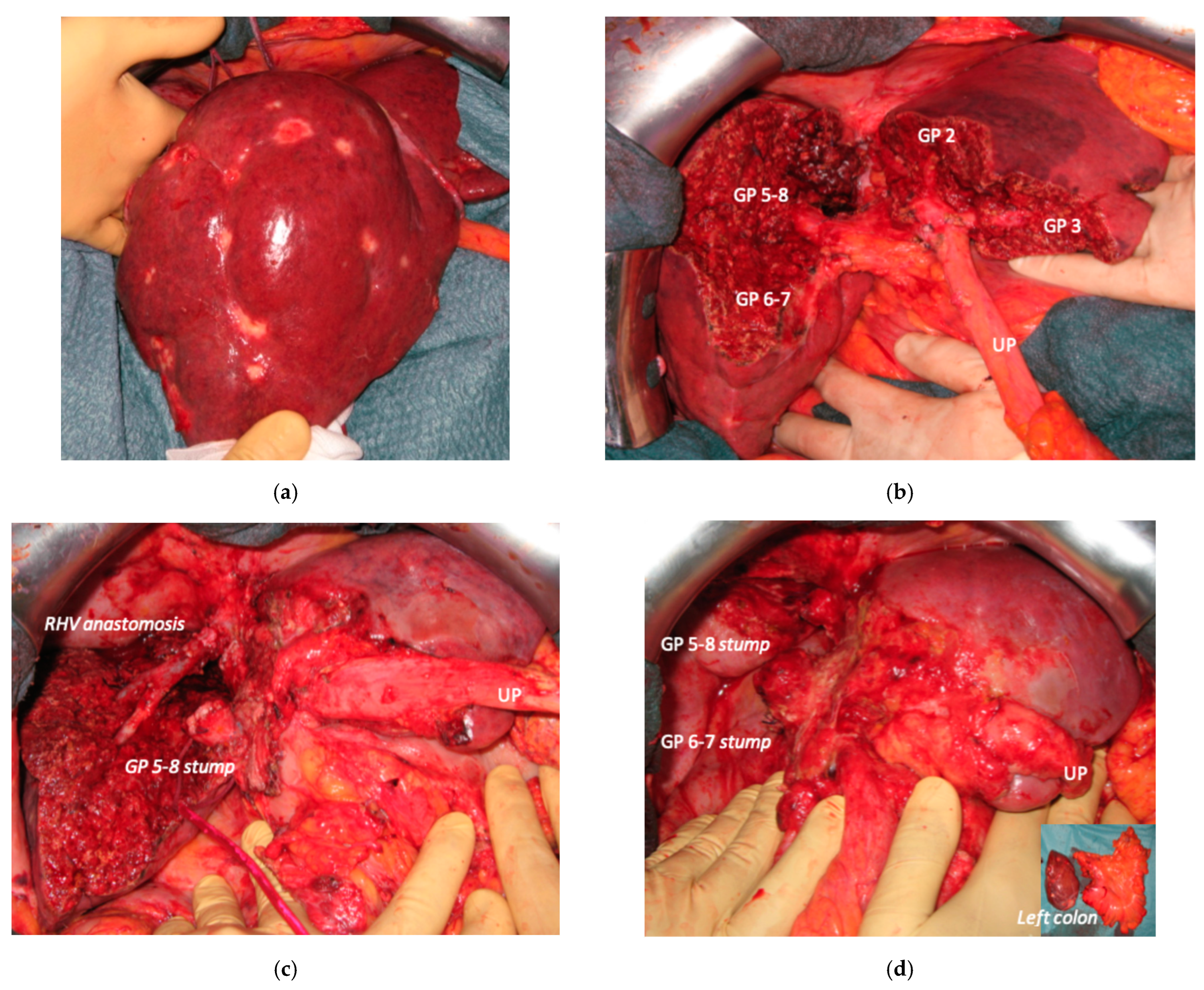 Cancers 15 04683 g011