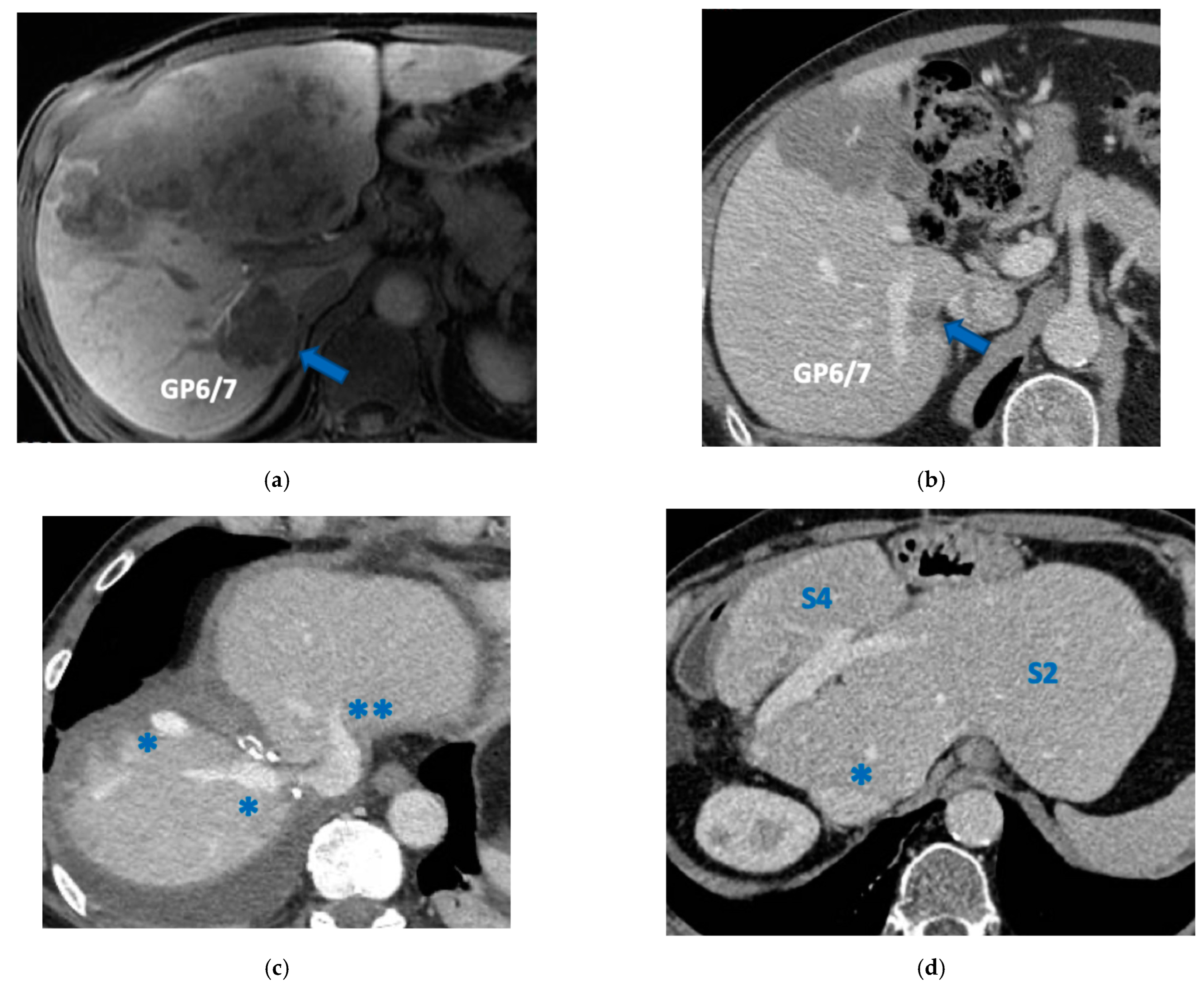 Cancers 15 04683 g012