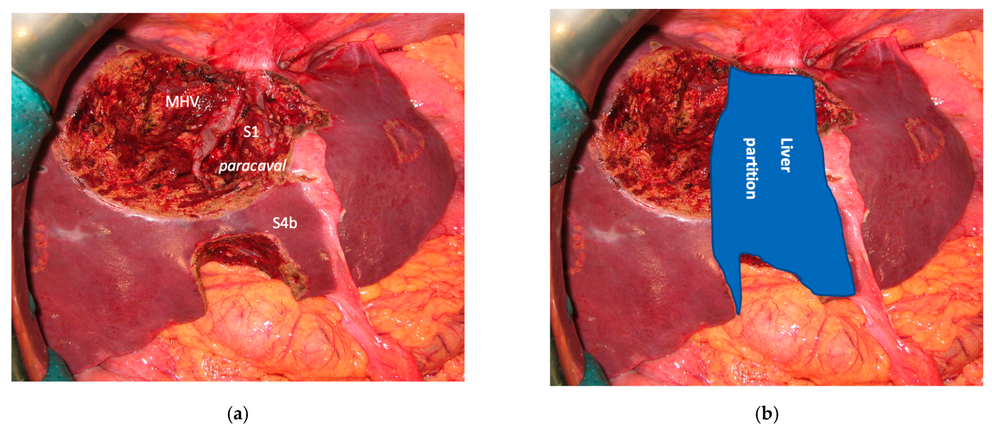 Cancers 15 04683 g016