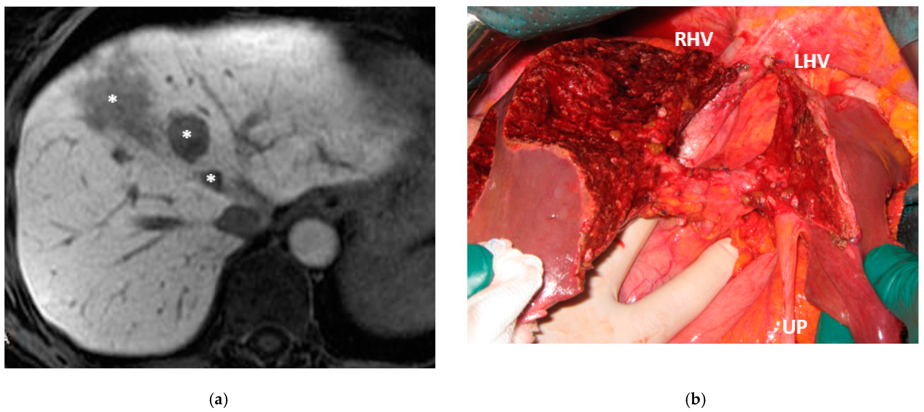 Cancers 15 04683 g017