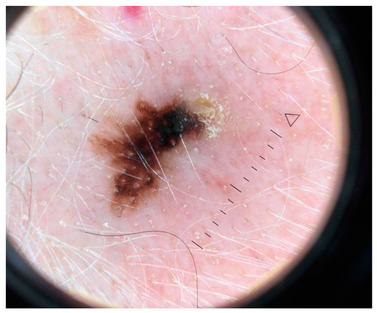 Cancers 15 04694 g003