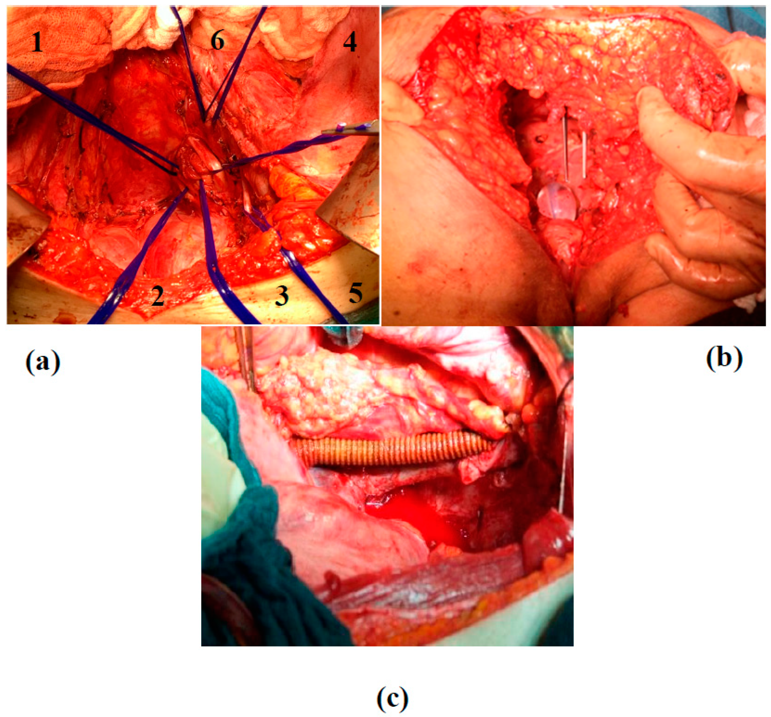 Cancers 15 04725 sch001