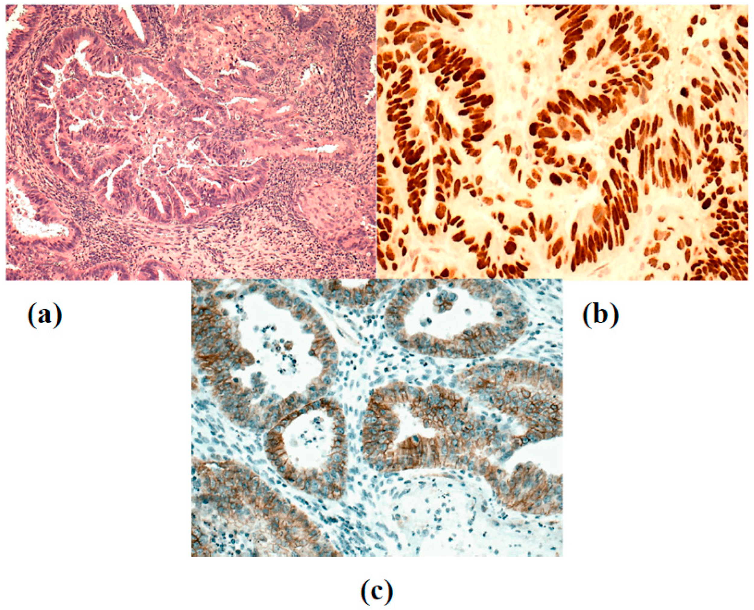 Cancers 15 04725 sch002